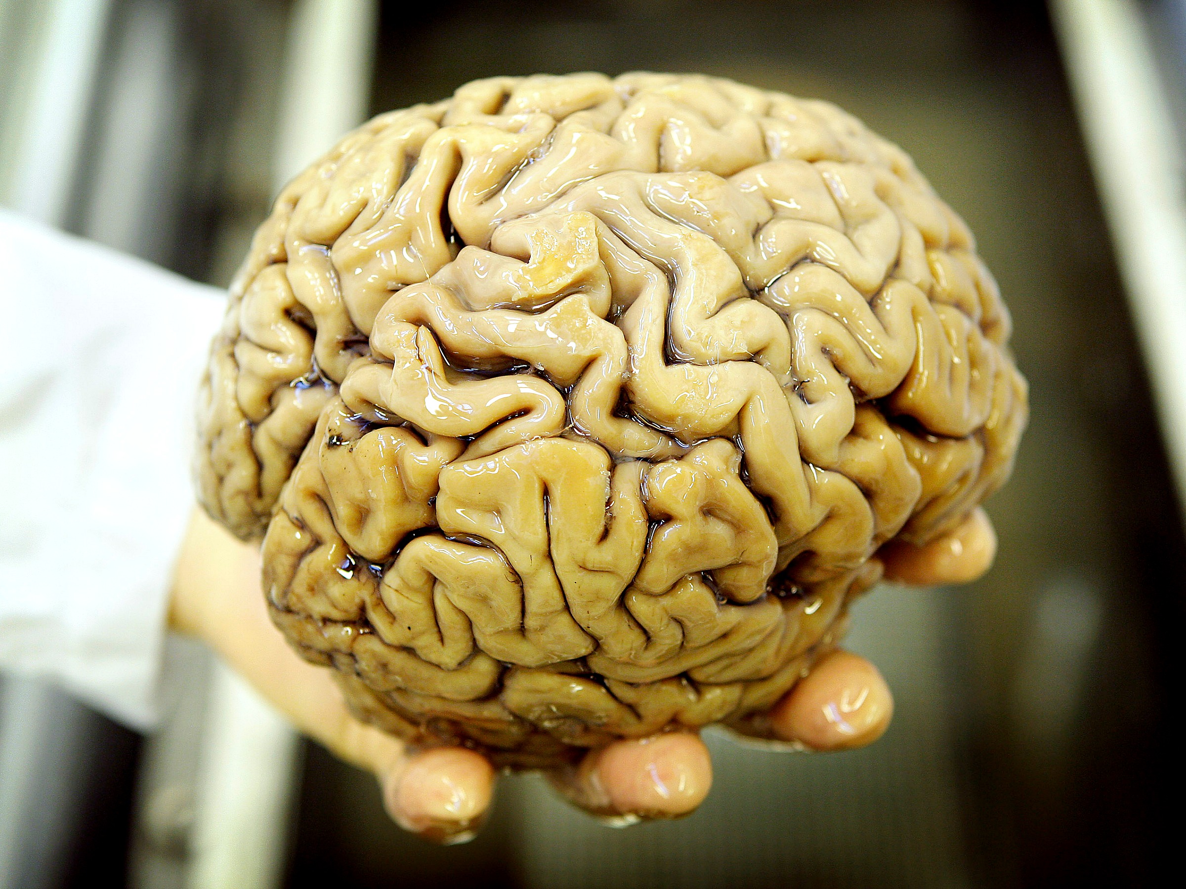 hersenen brein bioquark stamcellen dood leven