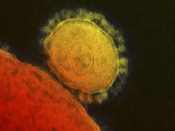 De grote problemen met het coronavirus zitten momenteel in drie landen: Italië, Zuid-Korea en Iran. Daar komen er op dagbasis nog honderden nieuwe meldingen van besmettingen met het coronavirus bij. Italië neemt inmiddels drastische maatregelen zoals een landelijke sluiting van scholen en universiteiten.