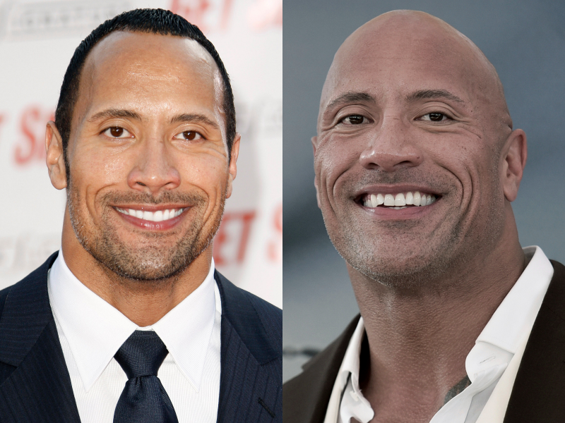 11 celebrities who are now rocking the bald look