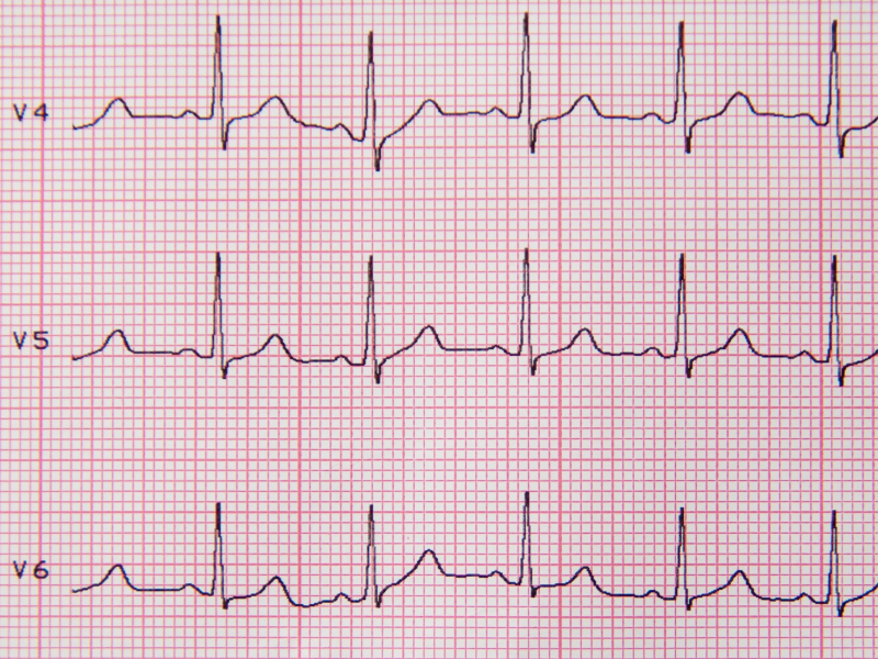 what-is-heart-rate-variability-how-to-measure-hrv-and-what-it-means