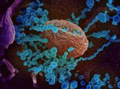 coronavirus medicijn: Wetenschappers van het Erasmus MC en de Universiteit Utrecht claimen de vondst van een antilichaam tegen COVID-19