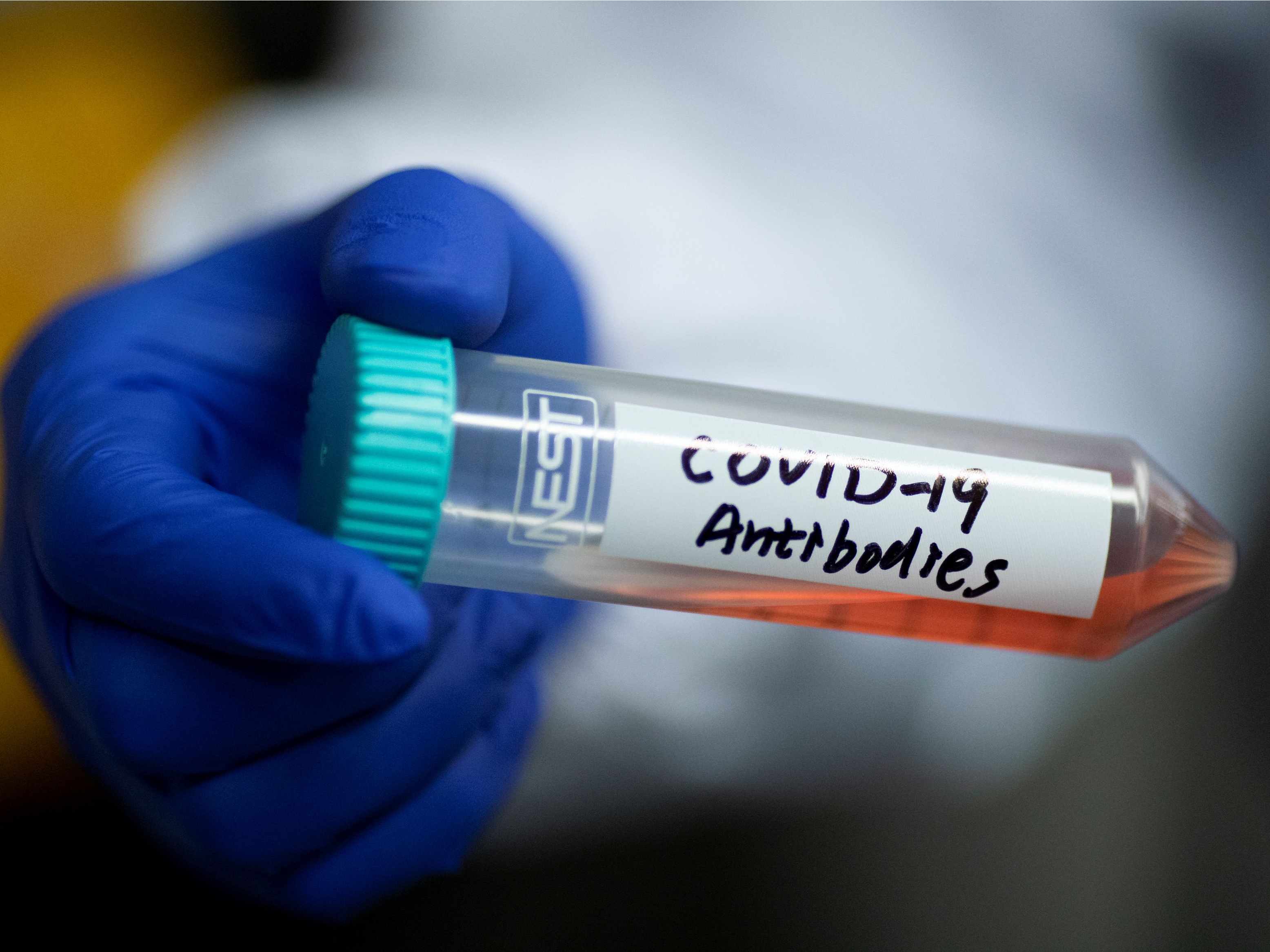 Wetenschappers zijn nog volop bezig om vragen rond immuniteit tegen het coronavirus te beantwoorden. Zo moet er meer duidelijkheid komen over de vraag of mensen die besmet zijn geweest opnieuw ziek kunnen worden, en hoelang je immuun blijft als je Covid-19 hebt gehad.