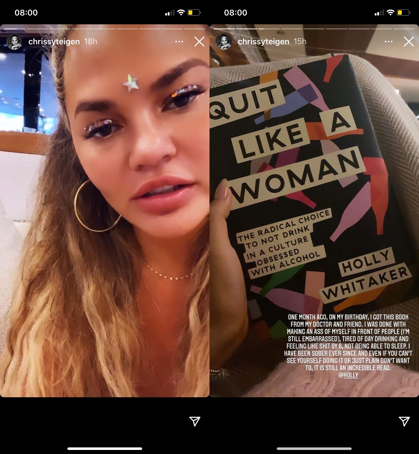 Chrissy Teigen