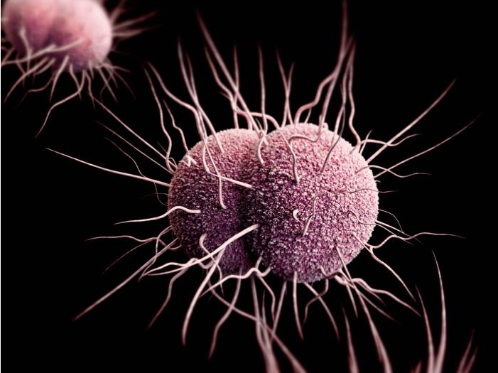 drug resistant gonorrhea