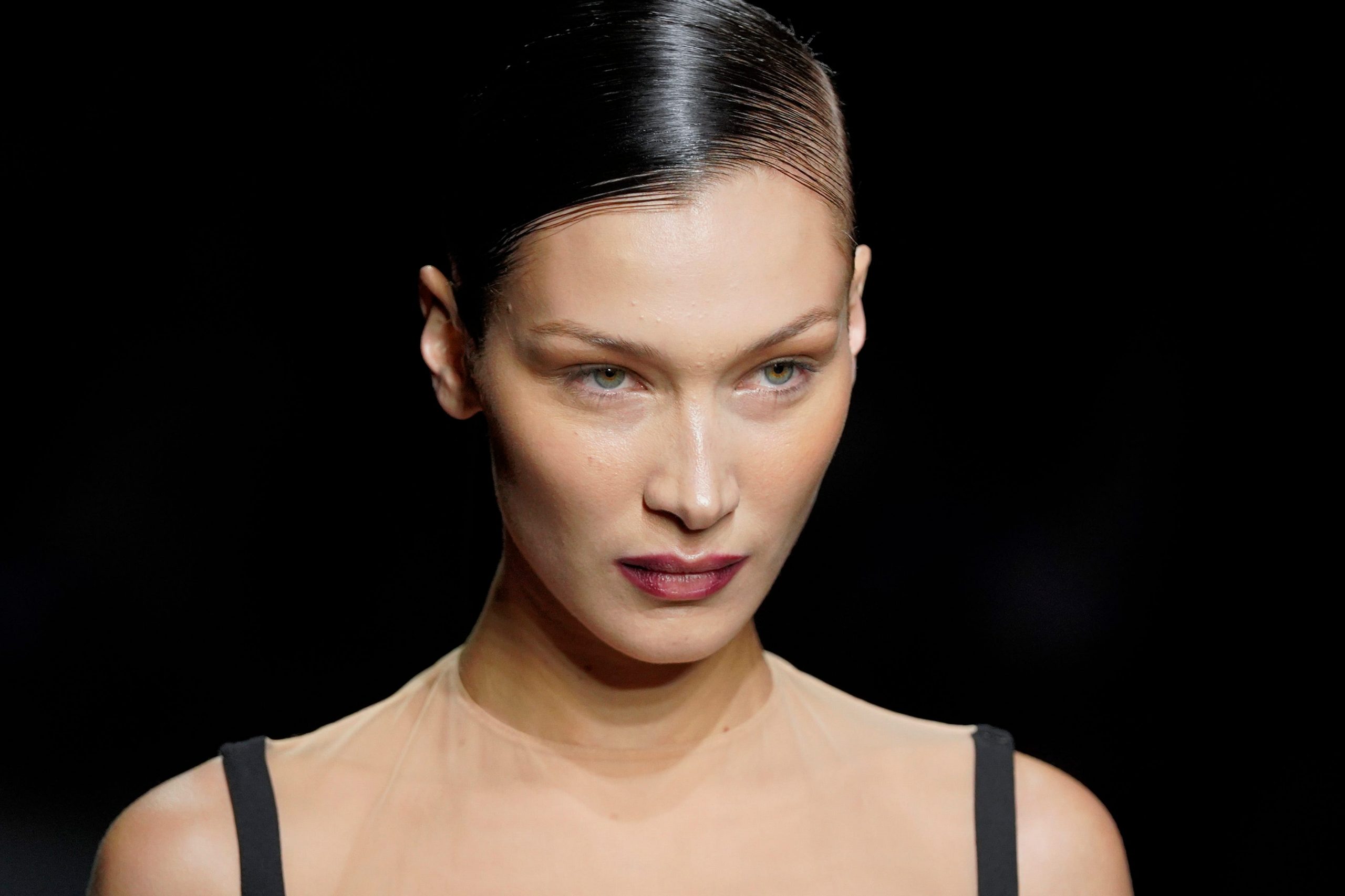 Why 'cat-eye' thread lifts are so popular right now, and how to decide ...