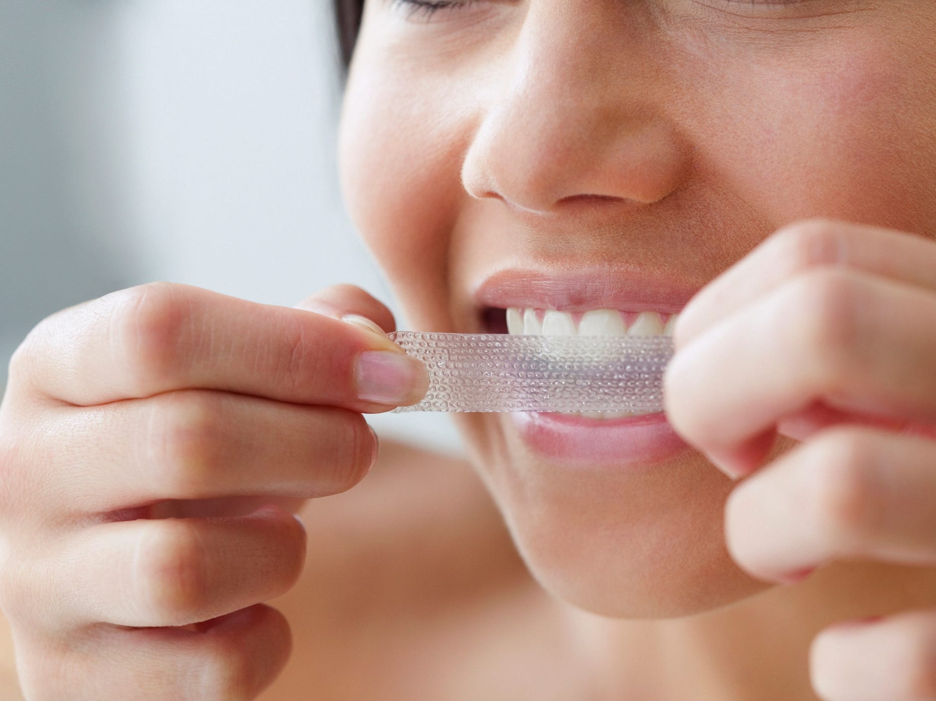 teeth whitening
