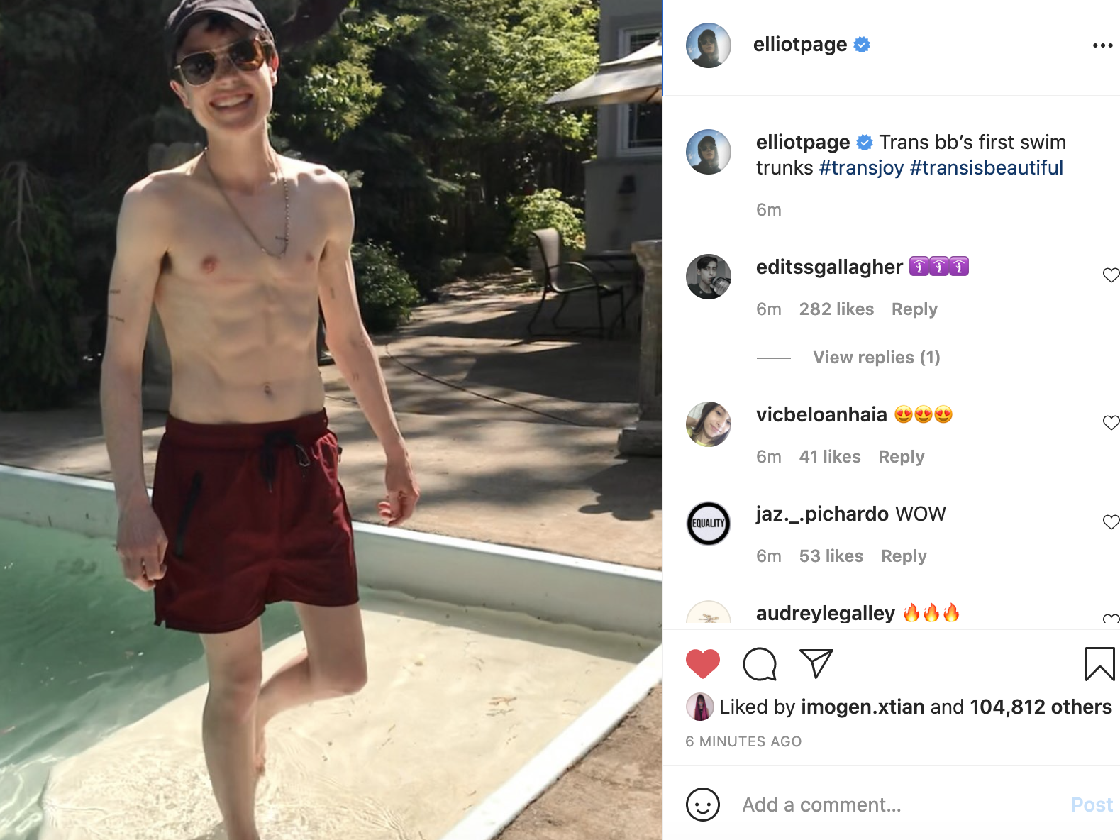 Elliot Page showing off his top surgery scars.
