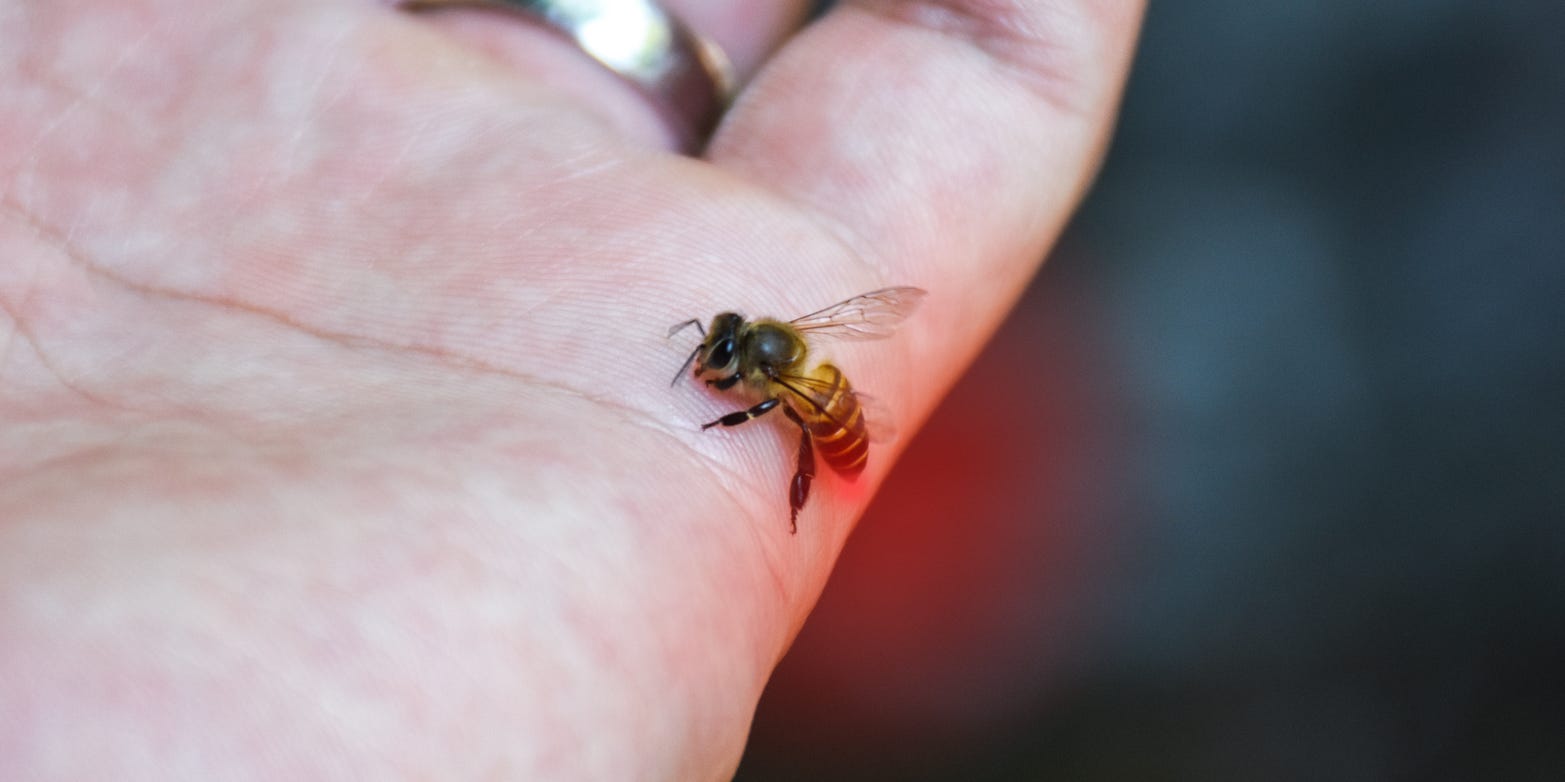 bee stinging hand