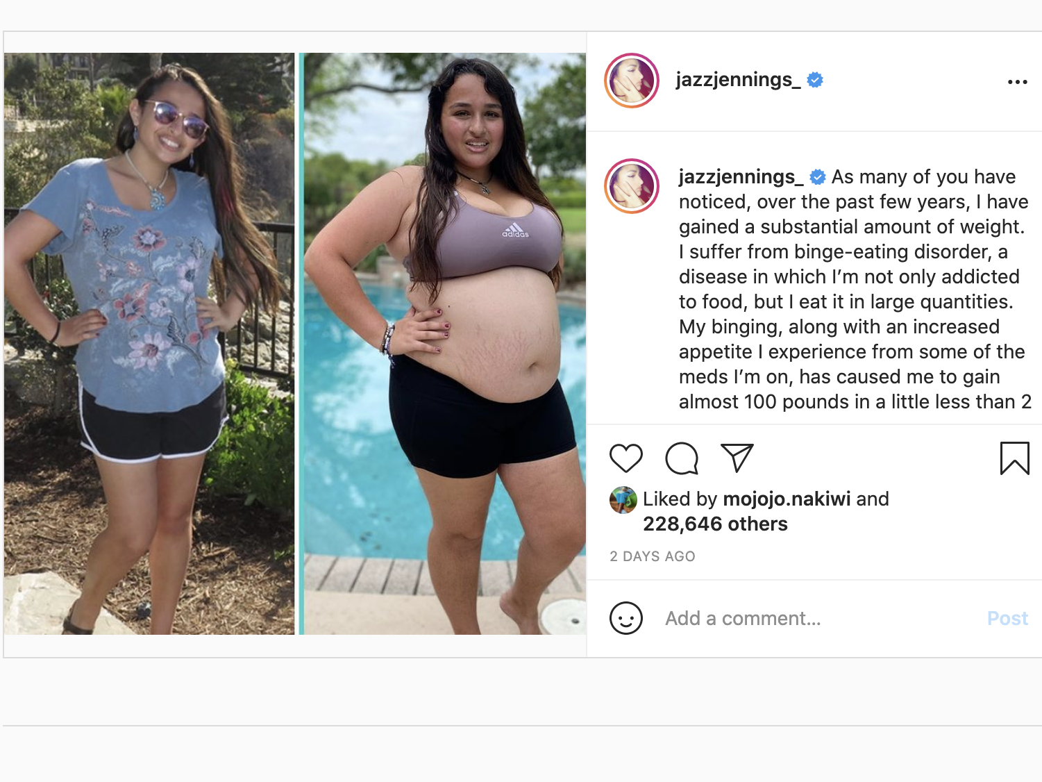 Jazz Jennings Binge eating disorder