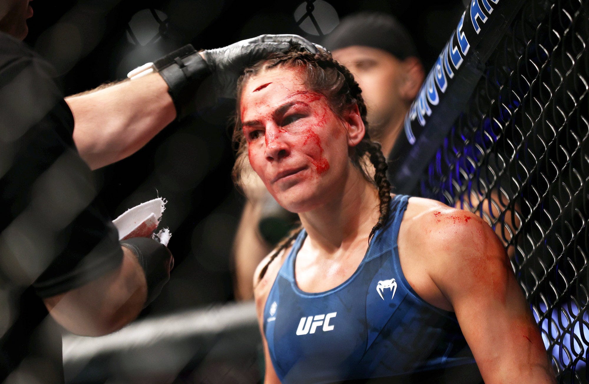 Jessica Eye receives treatment after her head was split open during an MMA match.