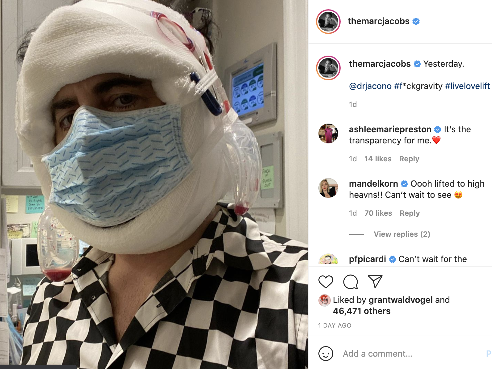 Marc Jacobs got a facelift