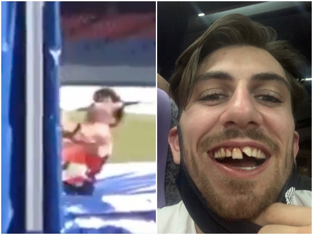 Harry Coppell broke his teeth when a bar fell on his face during Olympic pole vault training.
