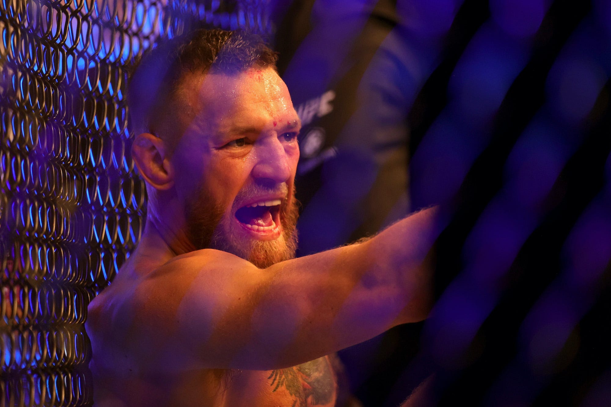 Conor McGregor yells angrily after breaking his leg during a July loss to Dustin Poirier.