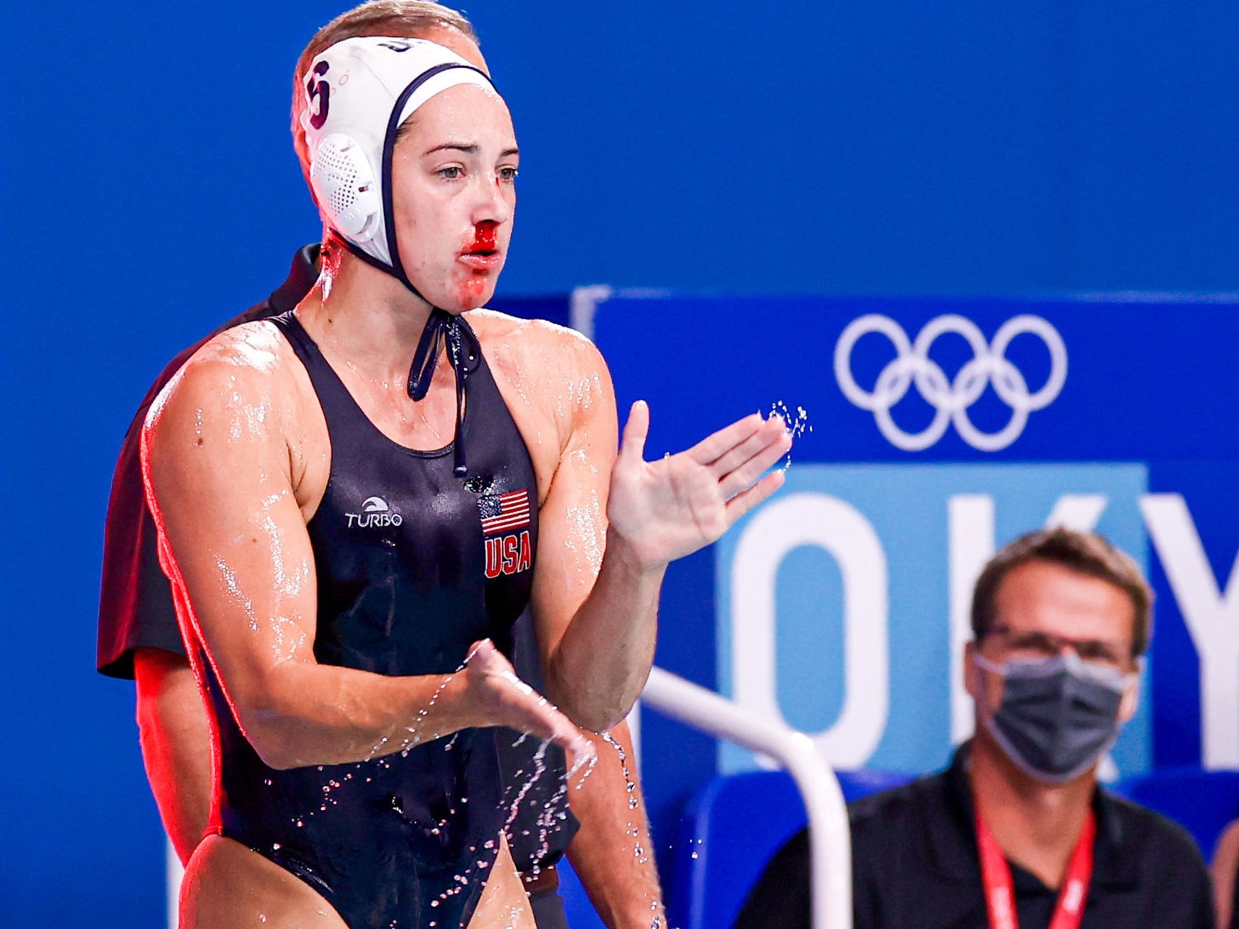 Margaret Steffens stands with an injured, bleeding nose at Tokyo 2020.