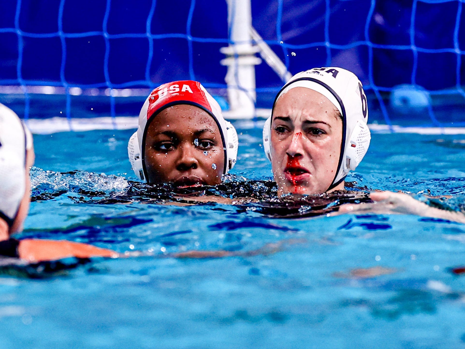 Maggie Steffens broke her nose in a match against China at Tokyo 2020.