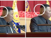Op tv-beelden van 30 juli is Kim Jong-un te zien met een pleister op zijn achterhoofd.