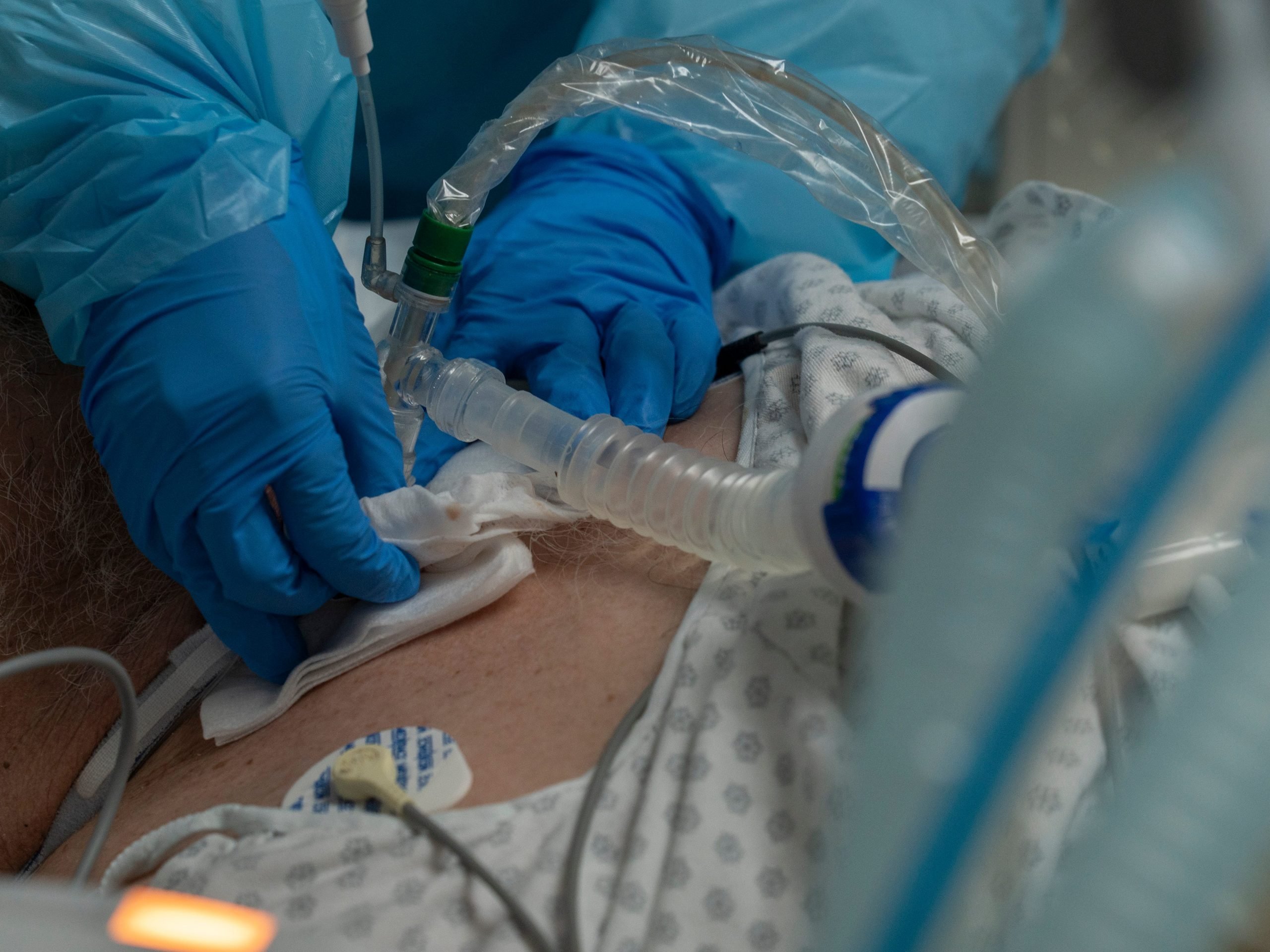 Medical staff member sets up a ventilator for a patient in the COVID-19 intensive care unit.