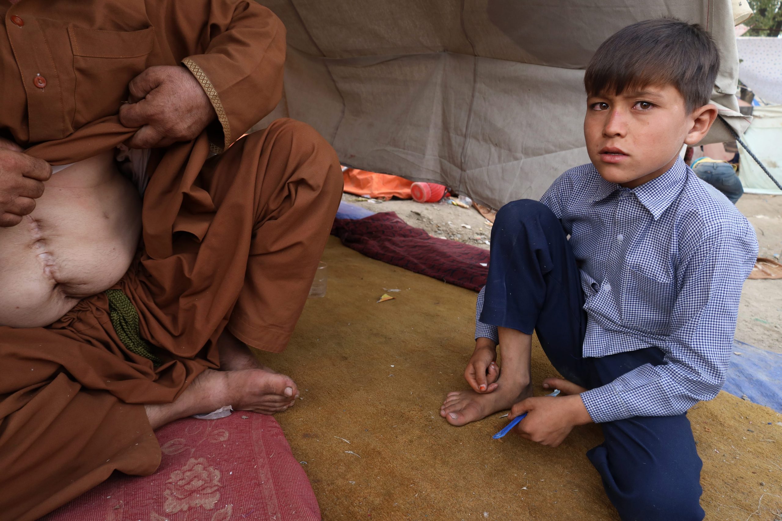 a man shows his injured belly next to his son in kabul