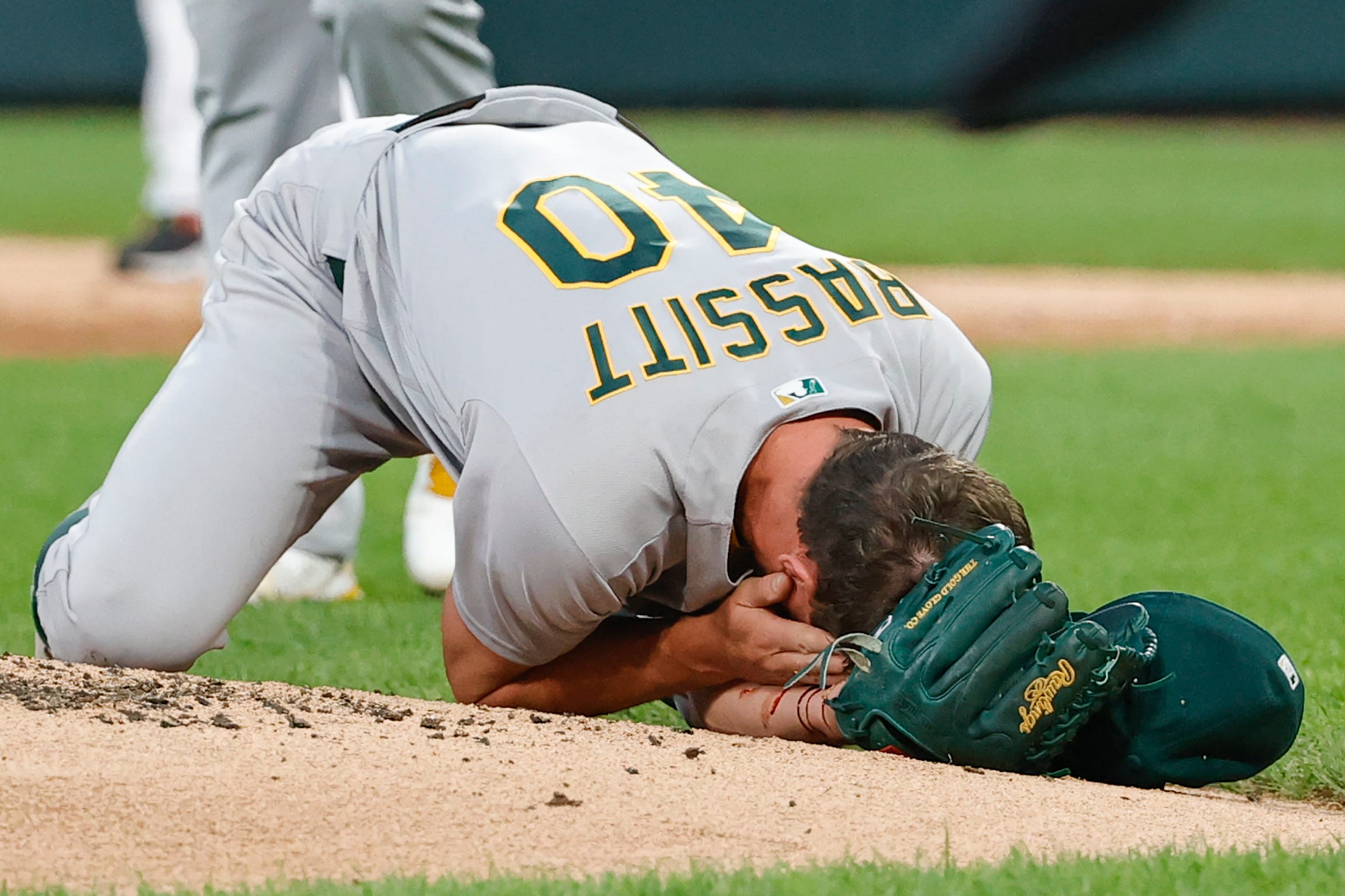 Oakland A's pitcher Chris Bassitt grabs his face after getting hit by a line drive.