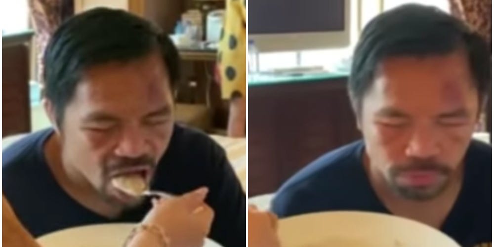 Jinkee Pacquiao spoon-feeds her husband Manny Pacquiao, who keeps his eyes shut while eating, three days after his recent boxing loss to Yordenis Ugas.