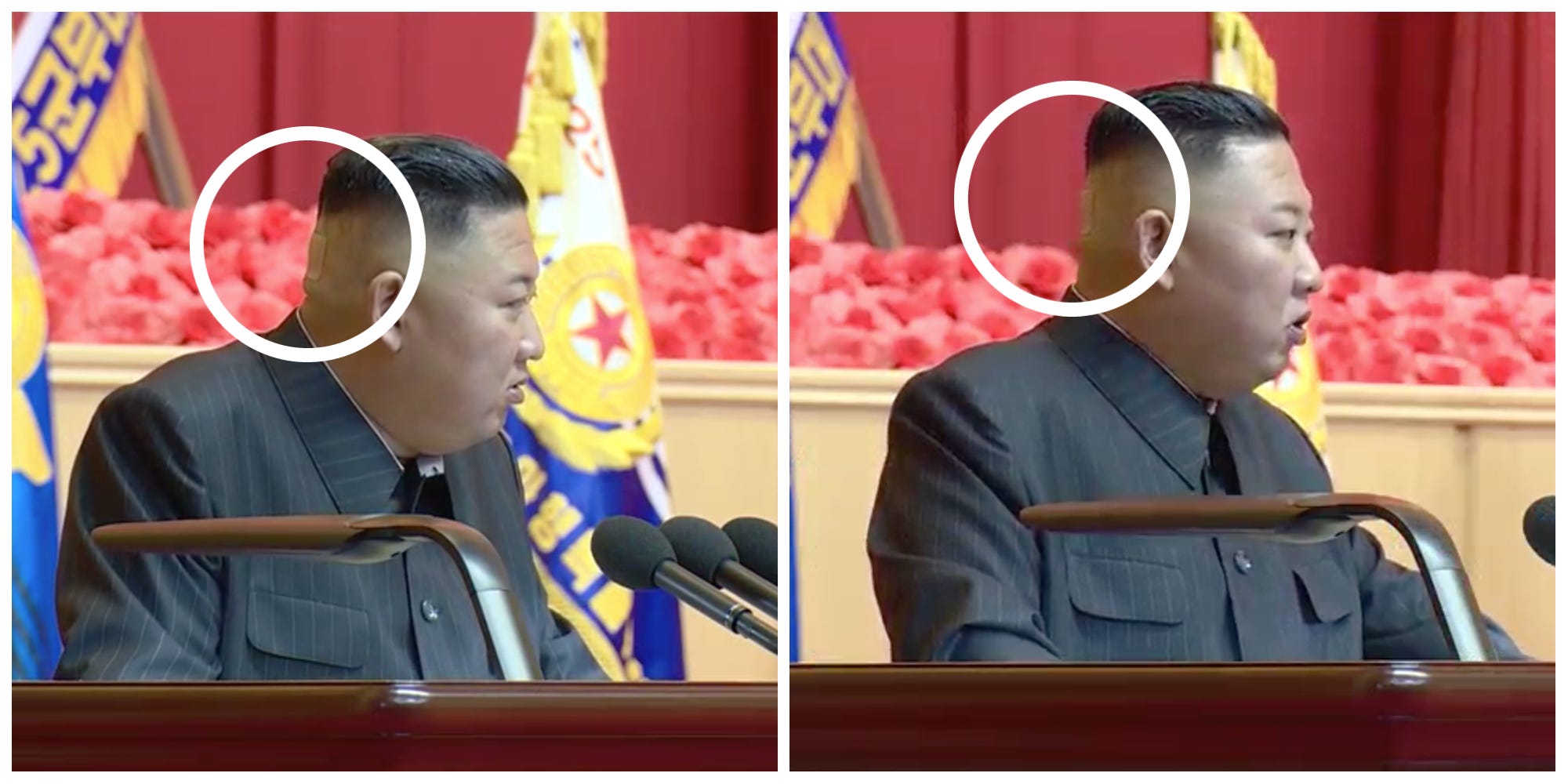 Twee foto's van Kim Jong-un waarop hij te zien is met een vreemde groene vlek en een pleister op het hoofd