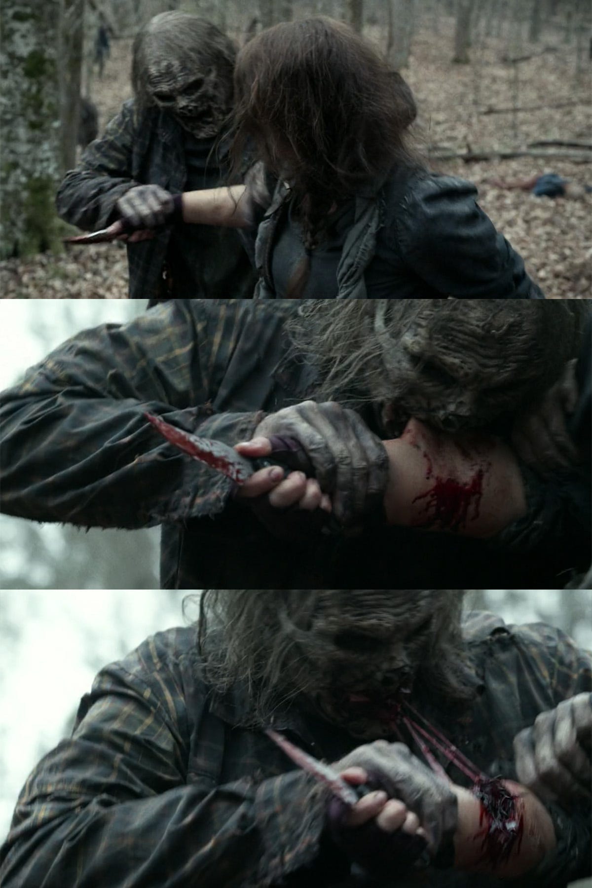 TWD 1103 Greg Nicotero walker bite