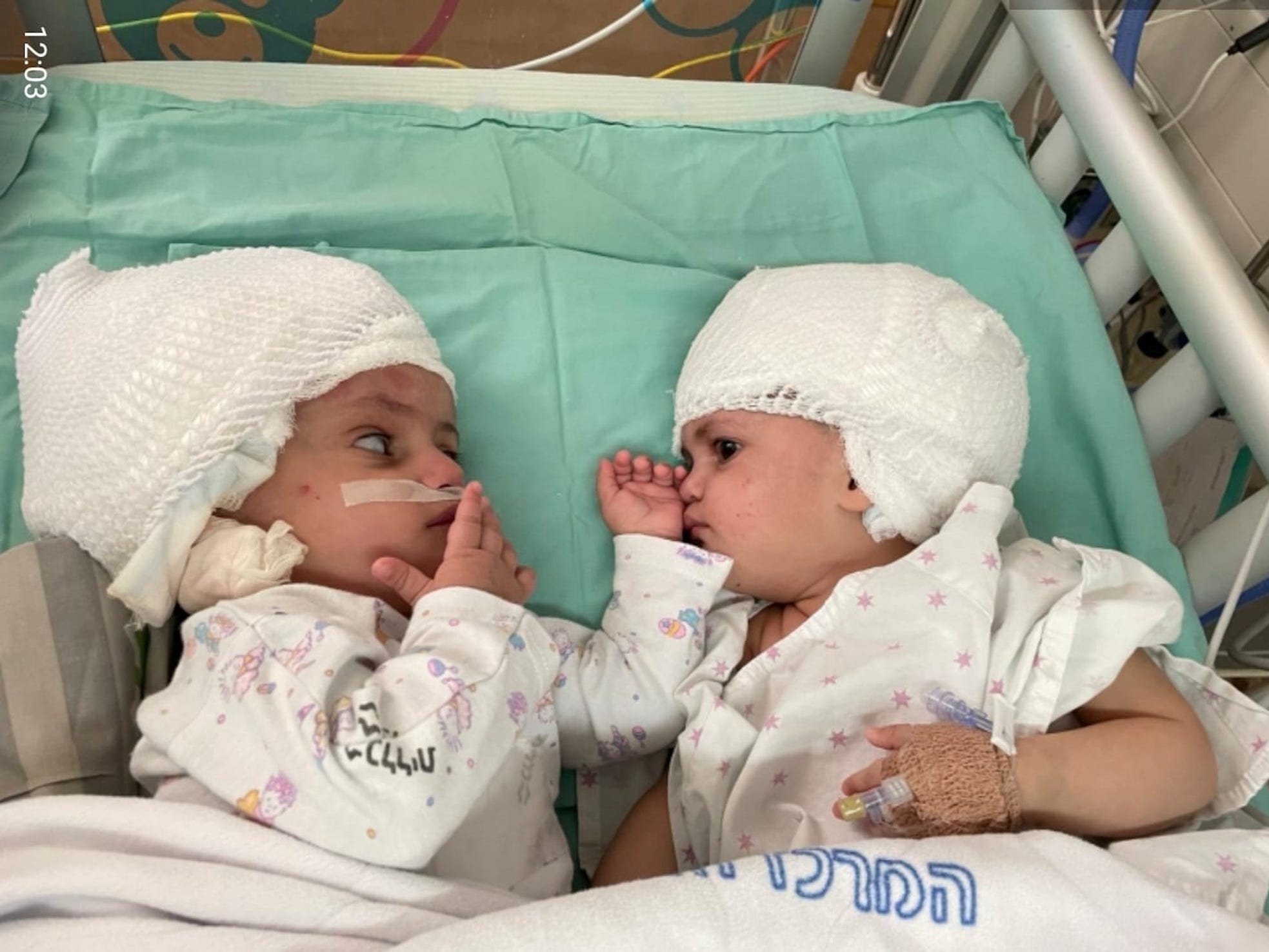 Two babies with the heads bandaged up are facing each other in a hospital cot.