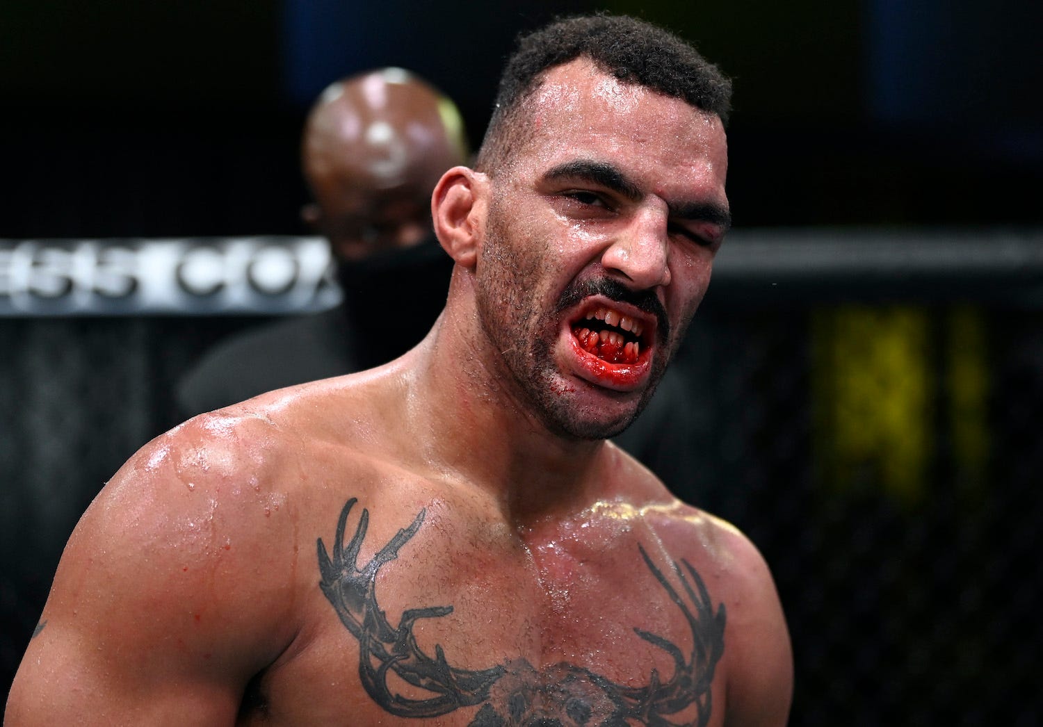 Devin Clark shows the wounds of war as his teeth look mangled after a UFC match.