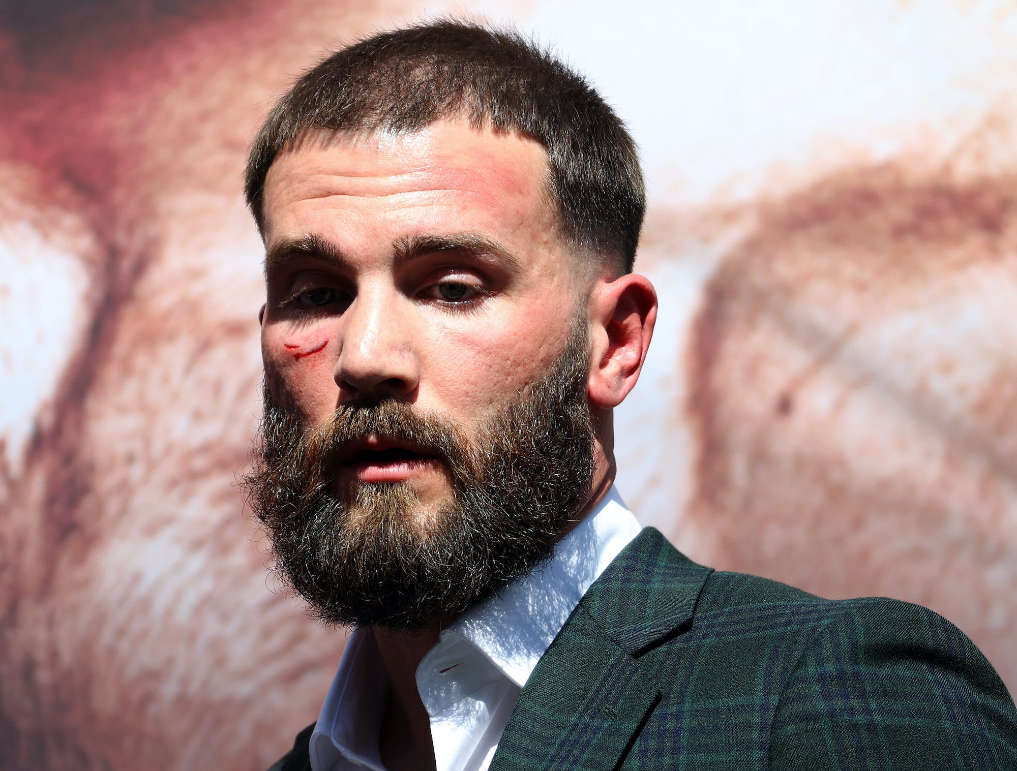 Caleb Plant was cut twice during the altercation with Canelo Alvarez.