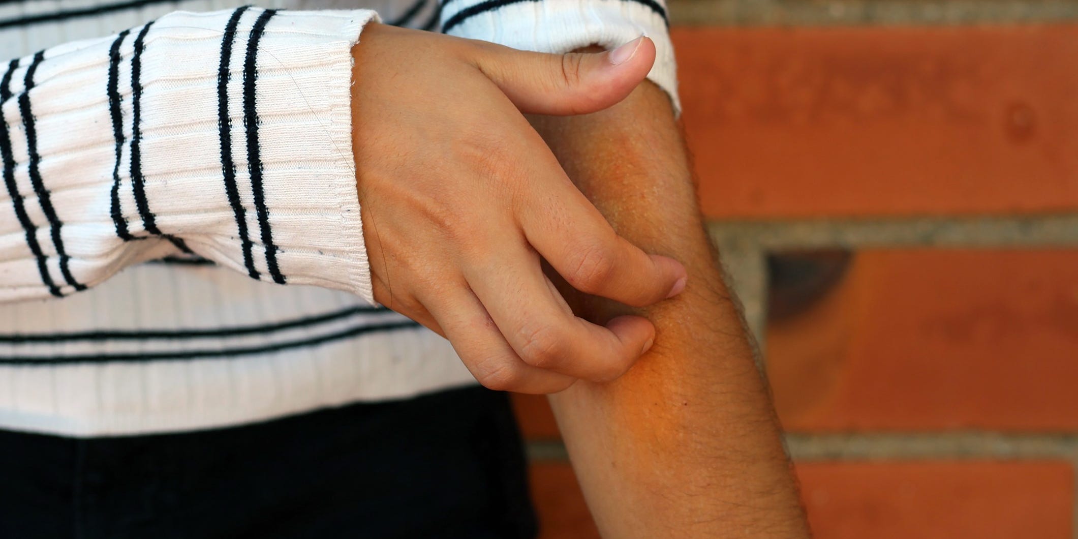 itchy rash on the elbow