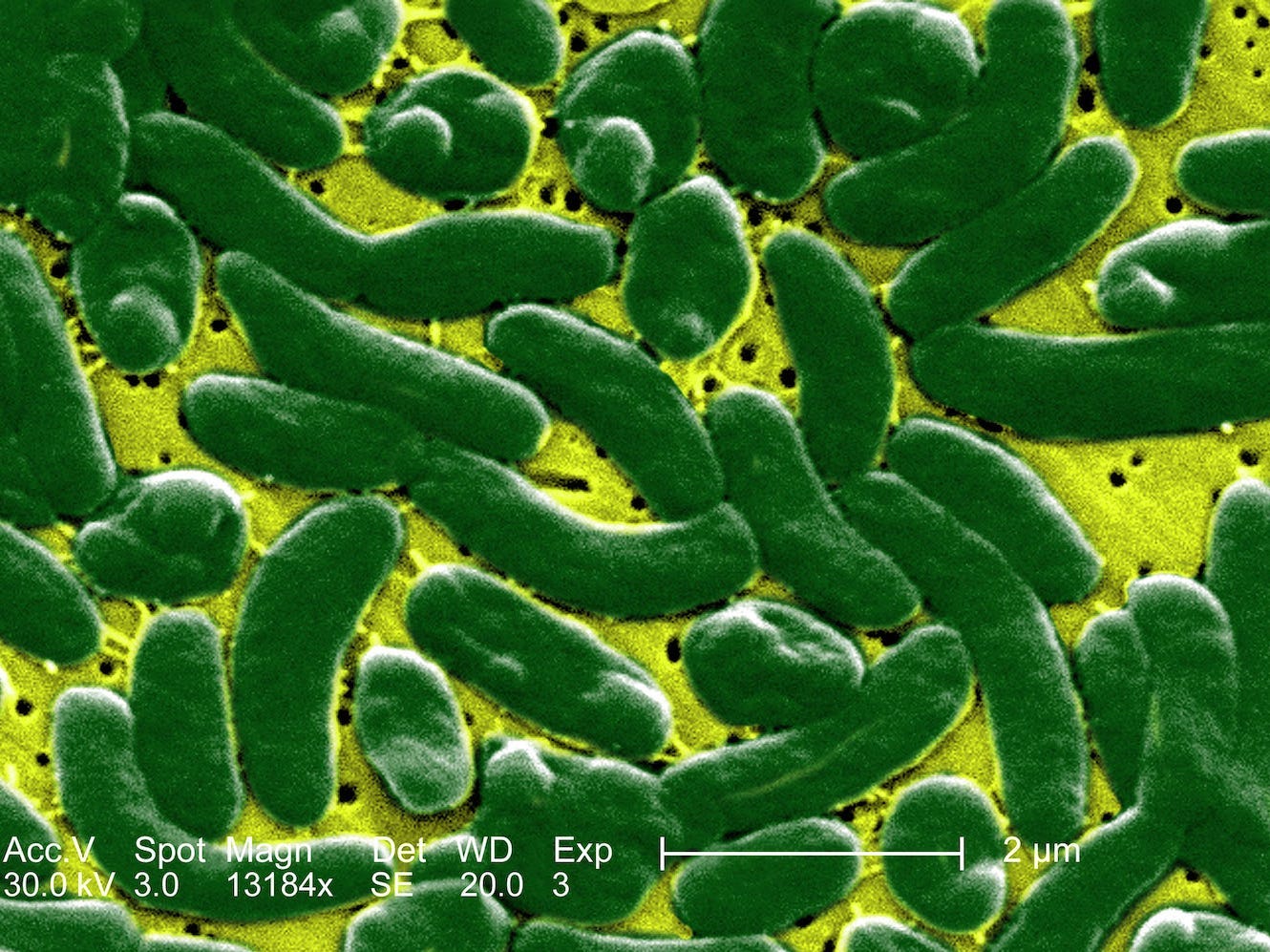 Vibrio vulnificus