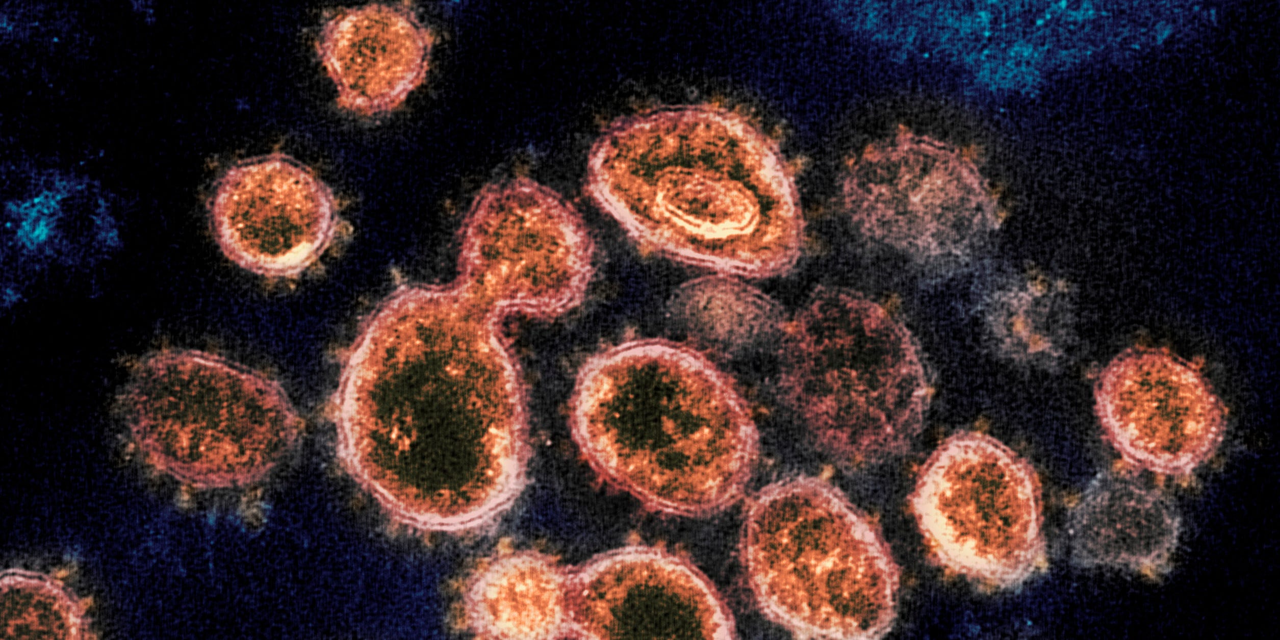 An electron microscope image shows SARS-CoV-2 virus particles which cause COVID-19, isolated from a patient in the U.S., emerging from the surface of cells cultured in a lab.