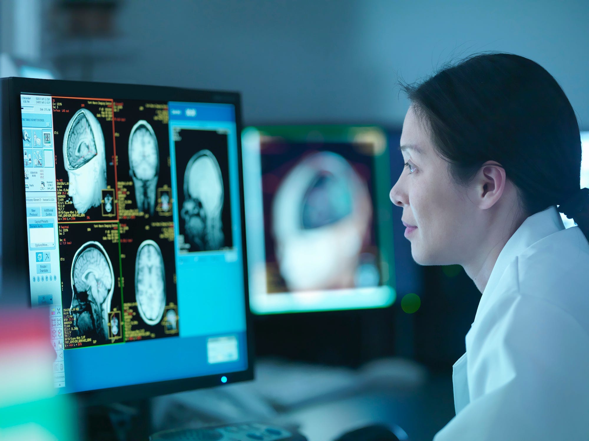 MRI tech looking at scans from Magnetic Resonance Imaging