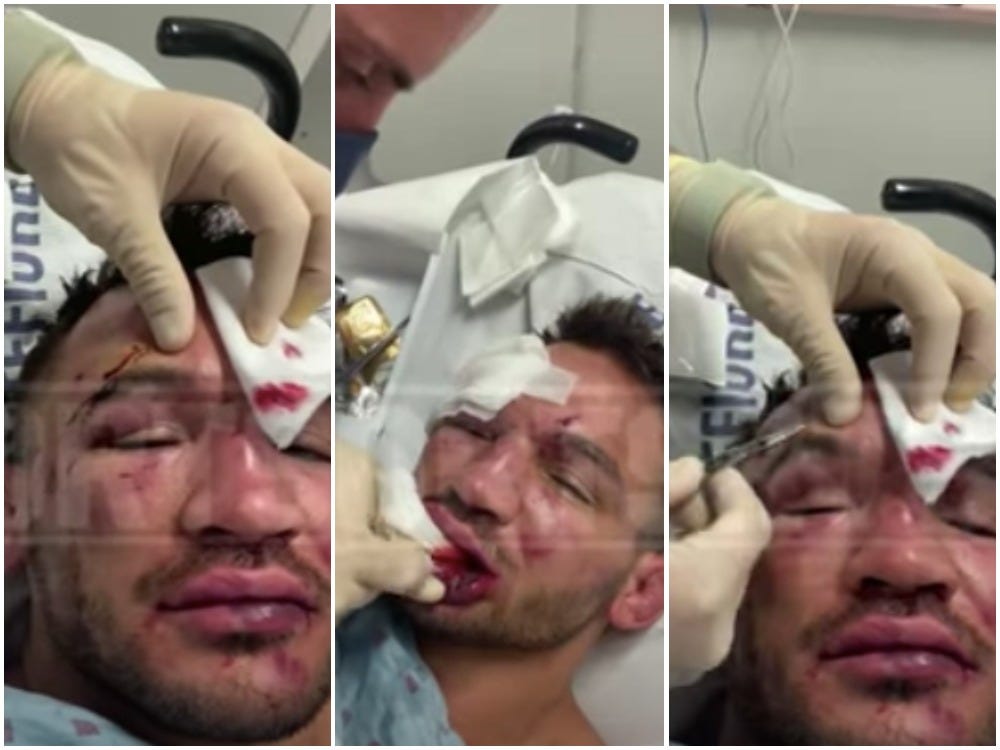 Michael Chandler receives hospital treatment after his UFC match with Justin Gaethje.