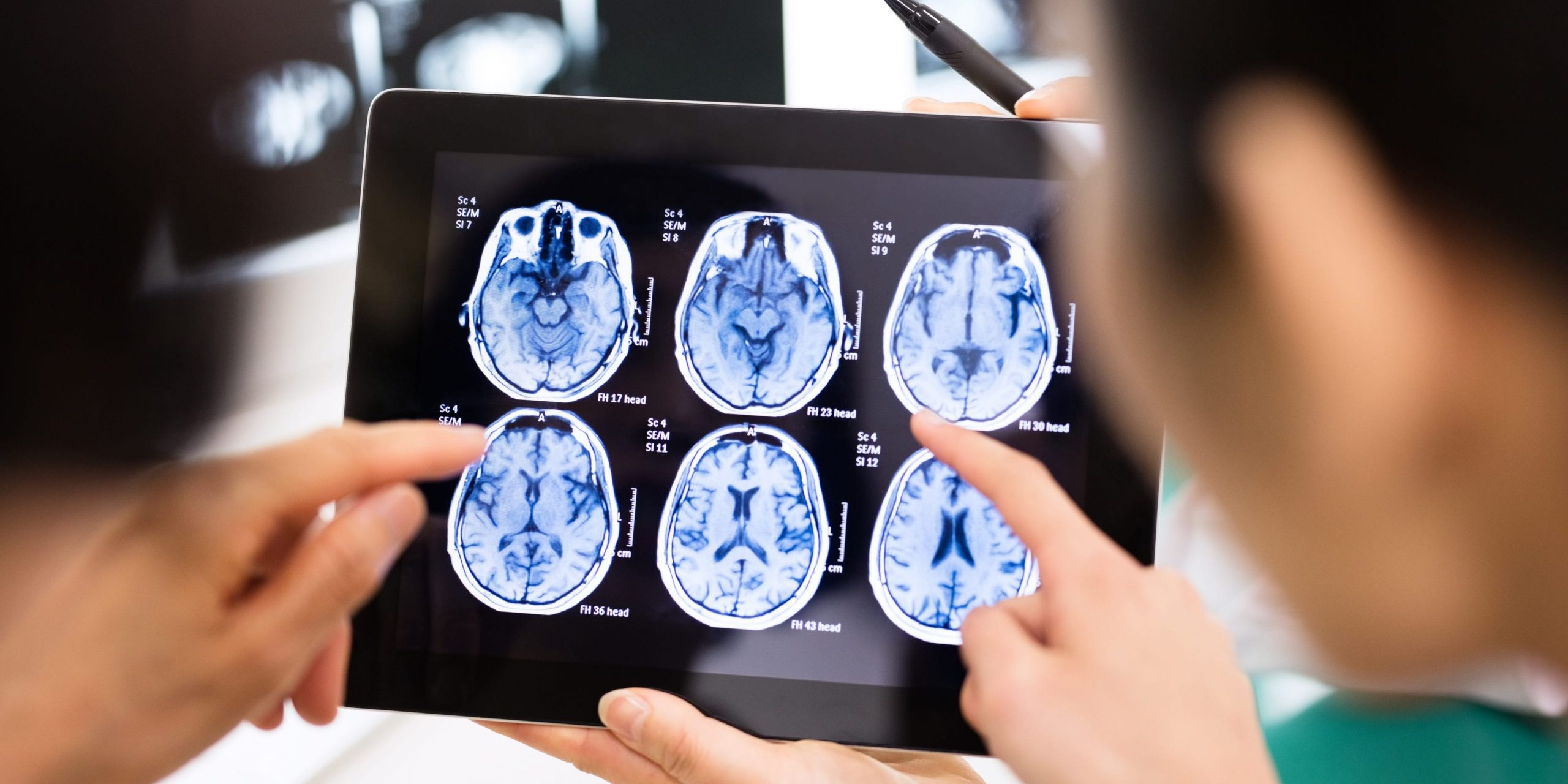 Two people at a hospital use a digital tablet to look at brain scans.