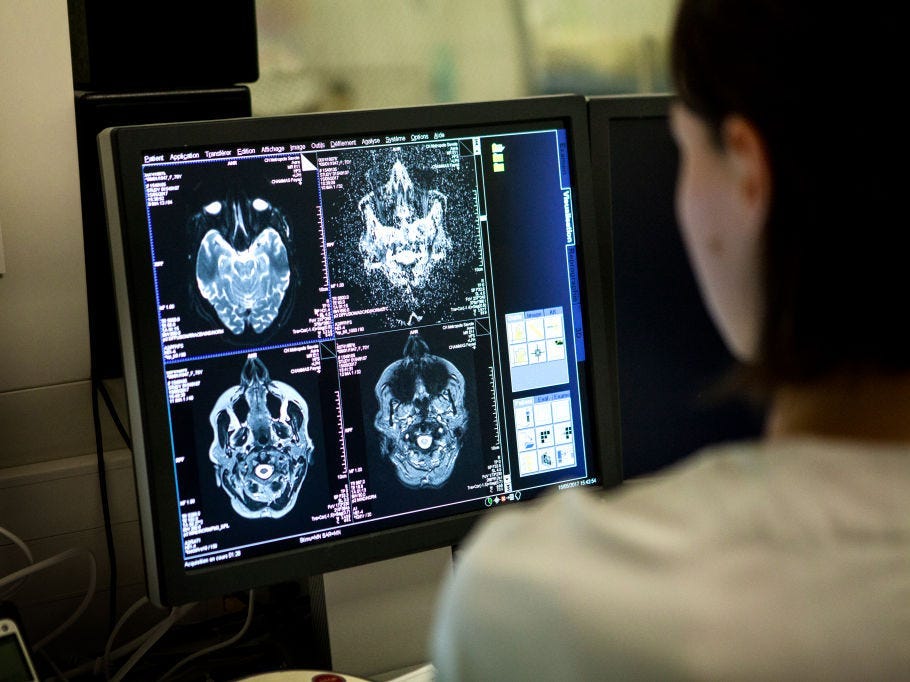 A technician looks at a computer screen showing a brain scan.