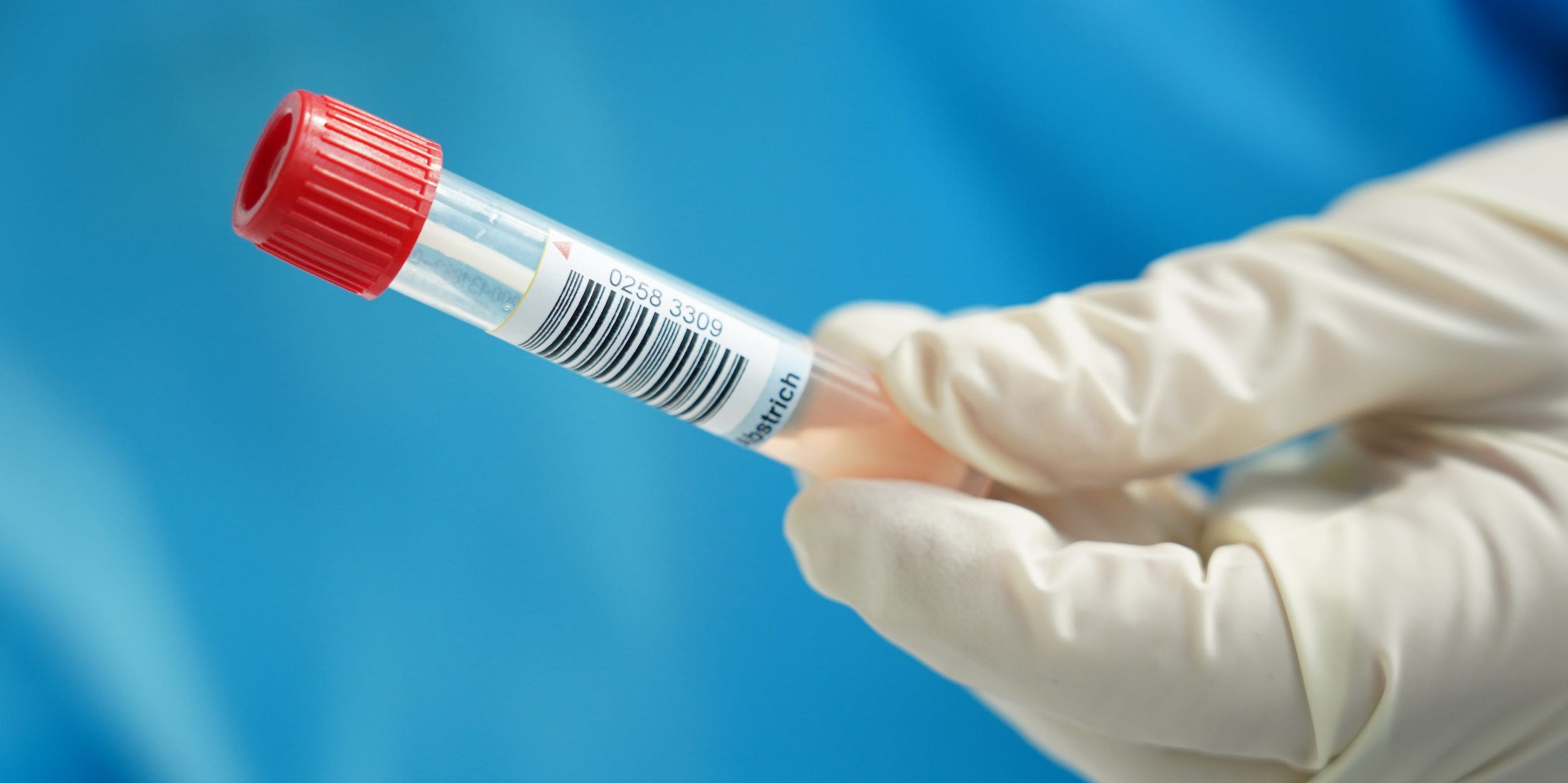 A nurse holds the tube containing the photographer's throat and nose swab sample for a Covid-19 test at a hospital on the 2nd day of his 14-day quarantine during the second wave of the coronavirus pandemic on October 29, 2020 in Stahnsdorf, Germany.