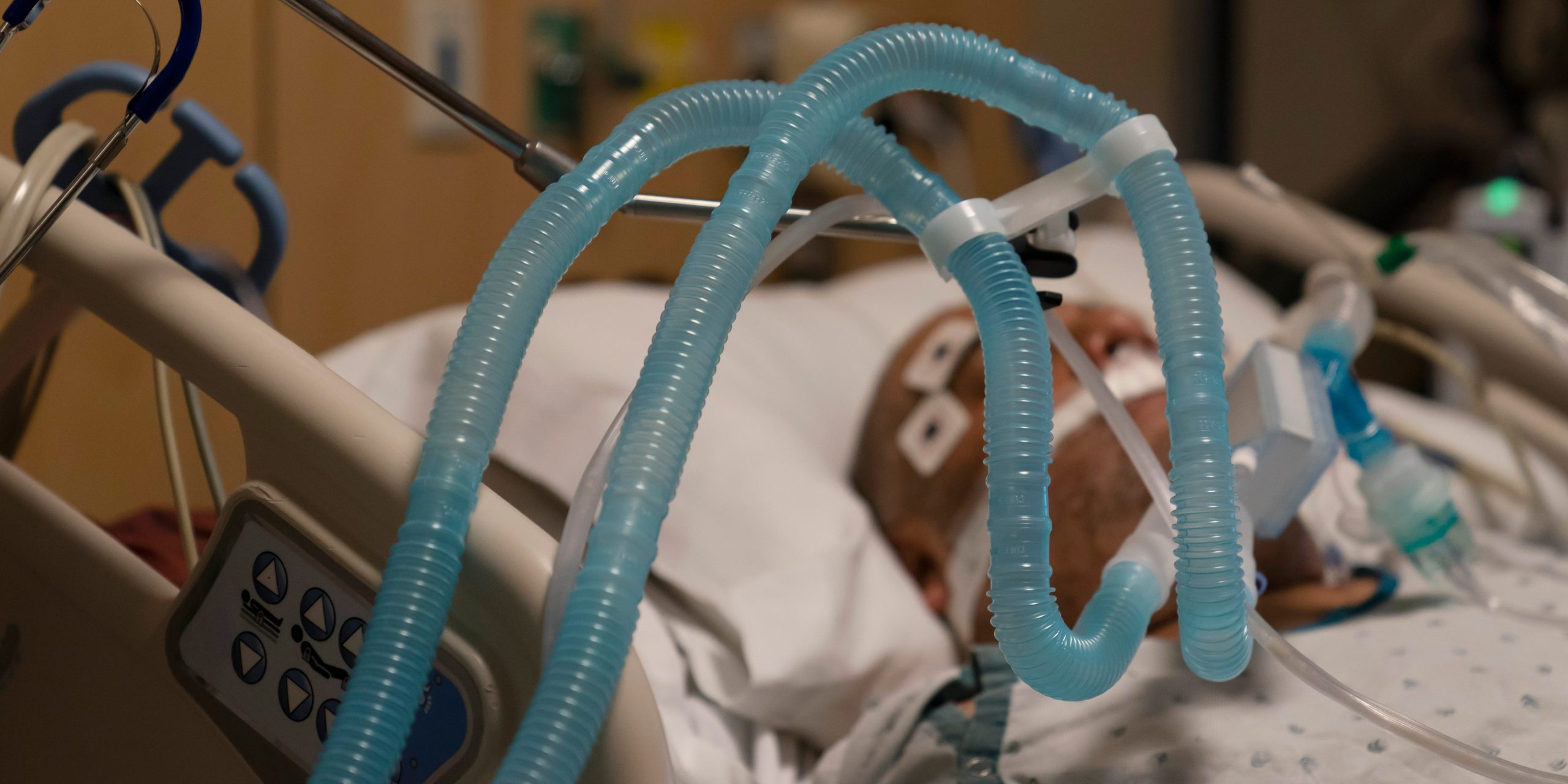 Tubes are attached to a COVID-19 patient.