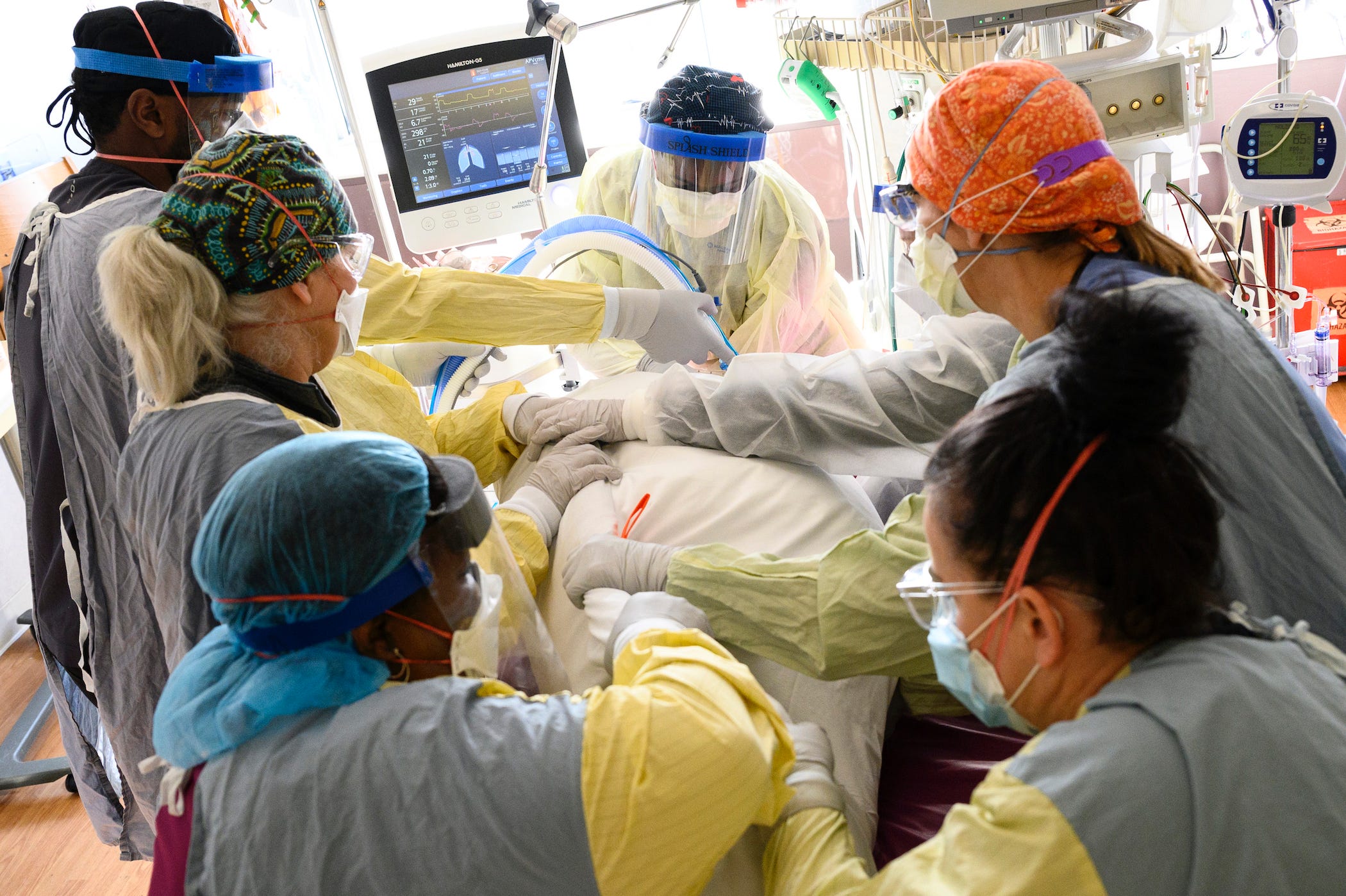 6 hospital staff all gathered around one intubated patient, working.