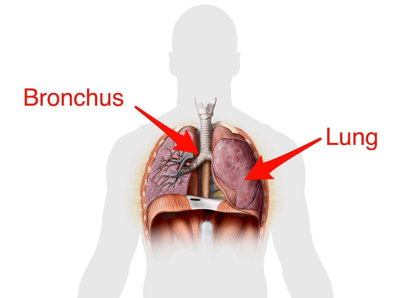 A schematic shows where the bronchus and lungs are on a cross-section of a person