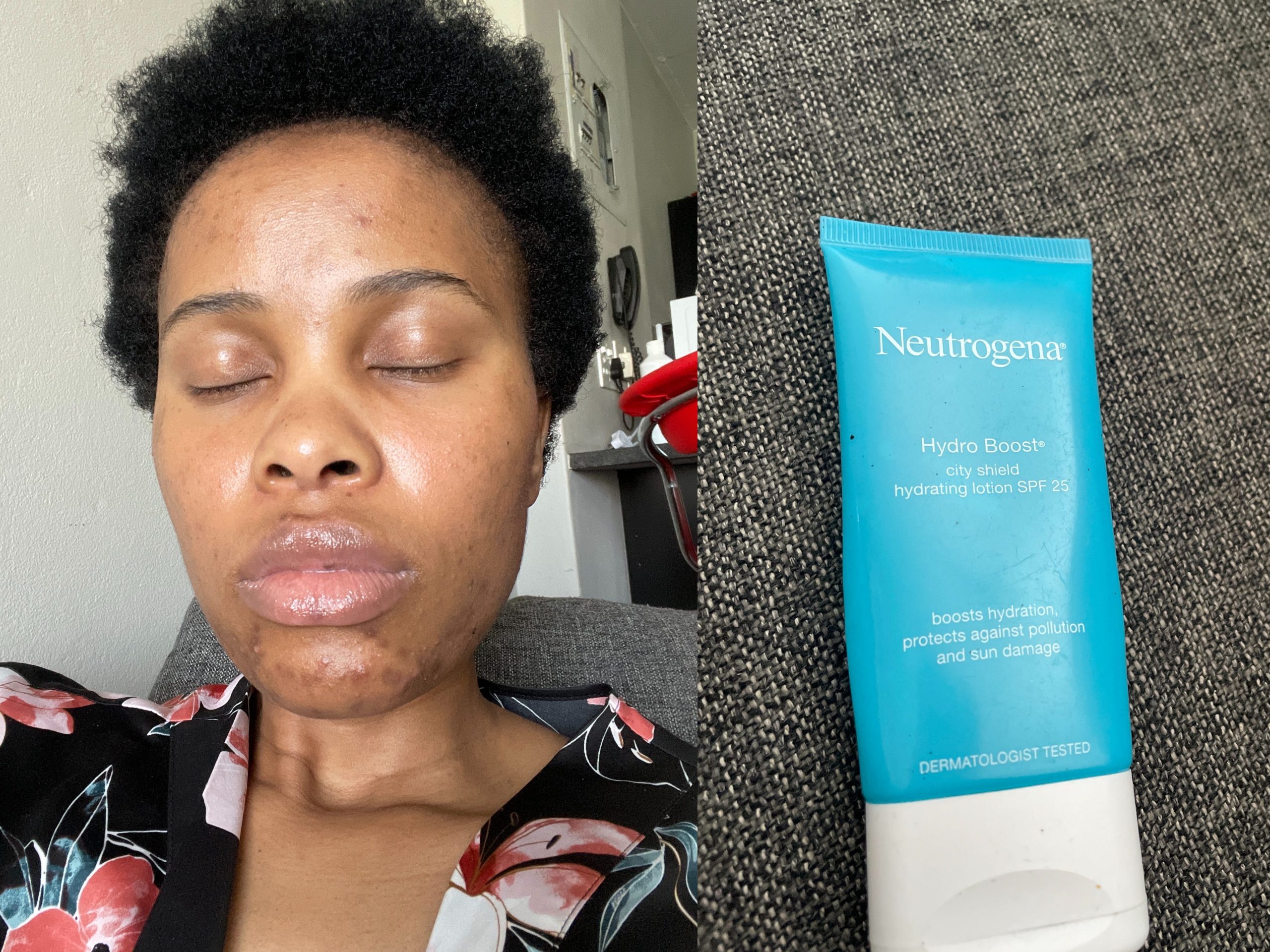 Thobeka Skin clinic