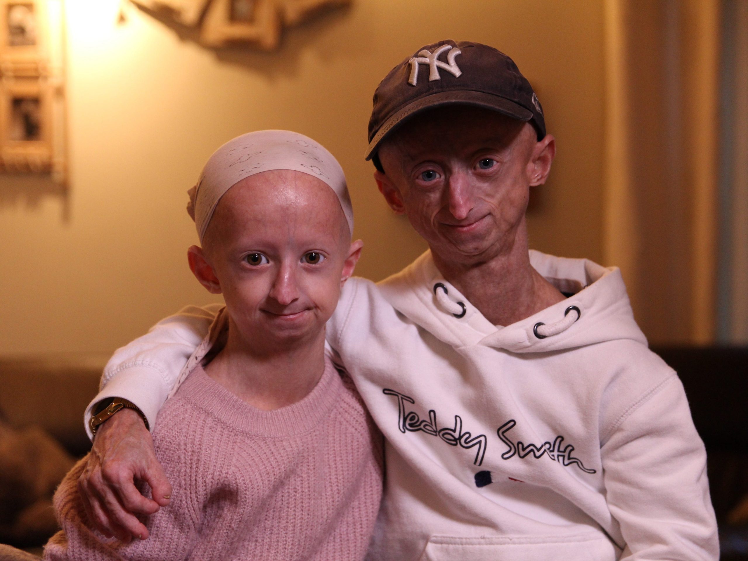 sibling with progeria