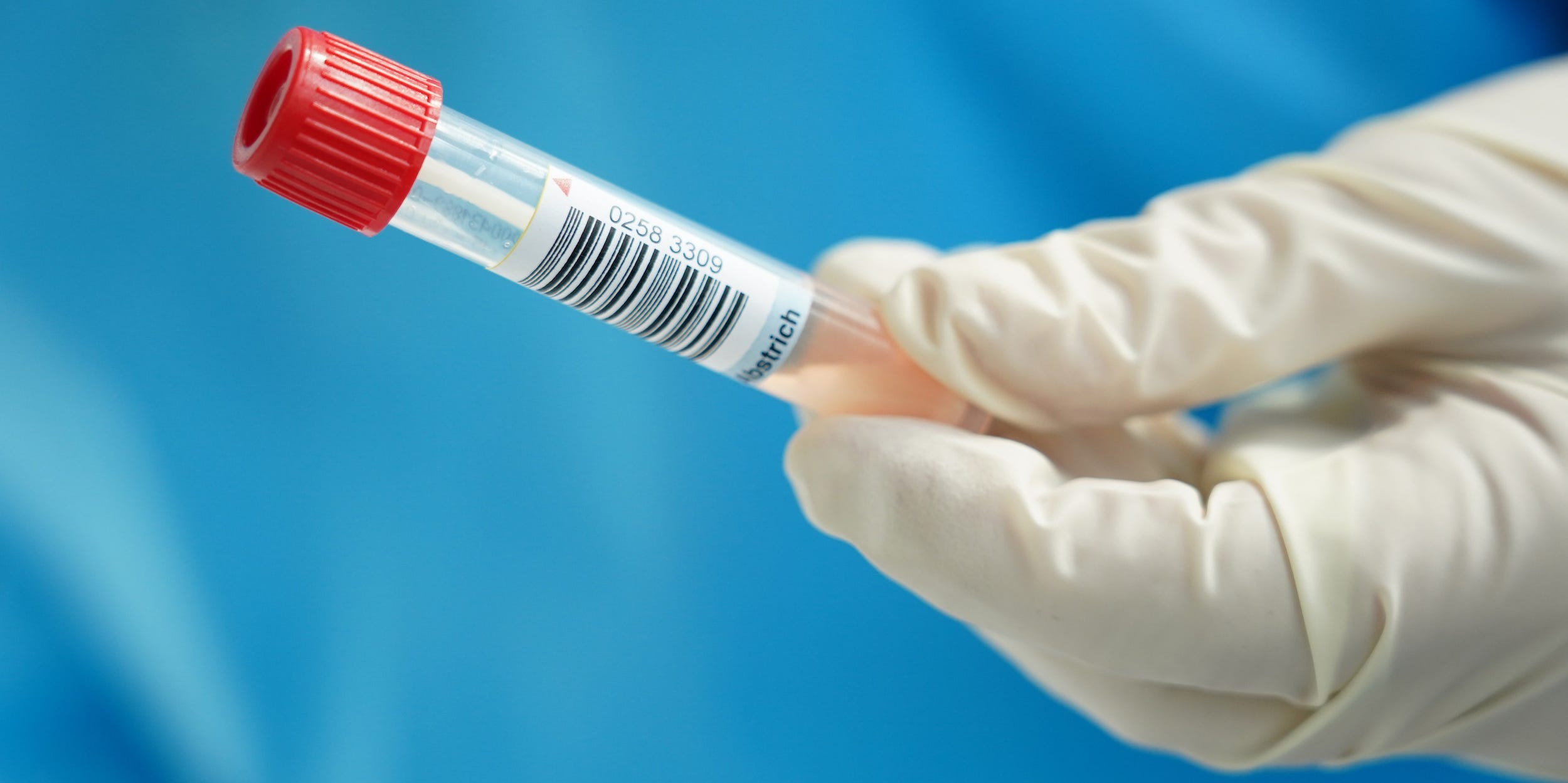 A nurse holds the tube containing the photographer's throat and nose swab sample for a Covid-19 test at a hospital on the 2nd day of his 14-day quarantine during the second wave of the coronavirus pandemic on October 29, 2020 in Stahnsdorf, Germany.