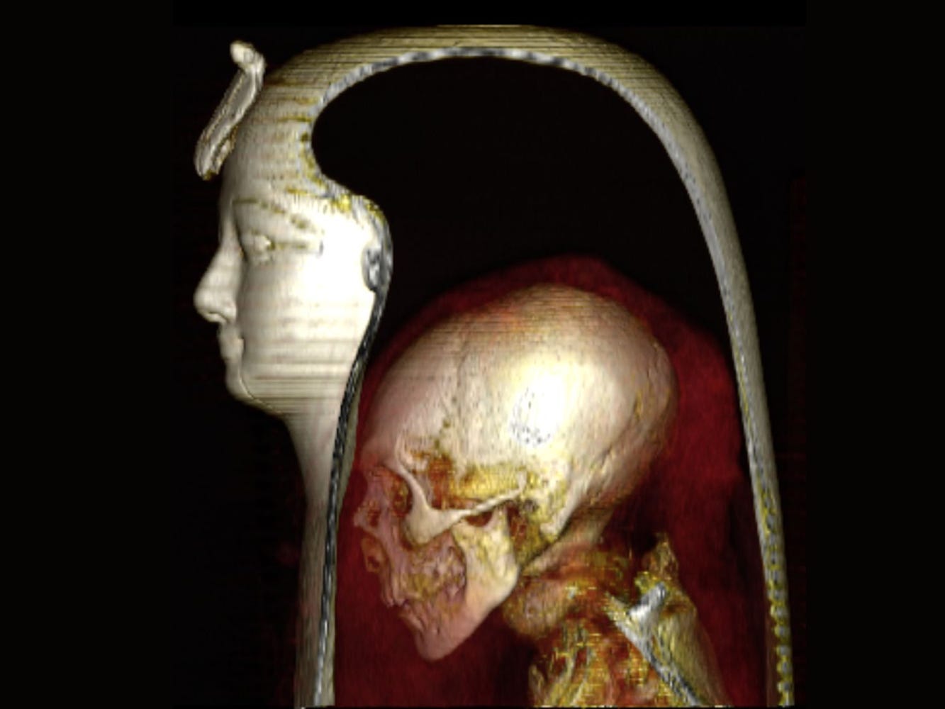 A picture shows a cross section of Amenhotep's mummy inside his face inset