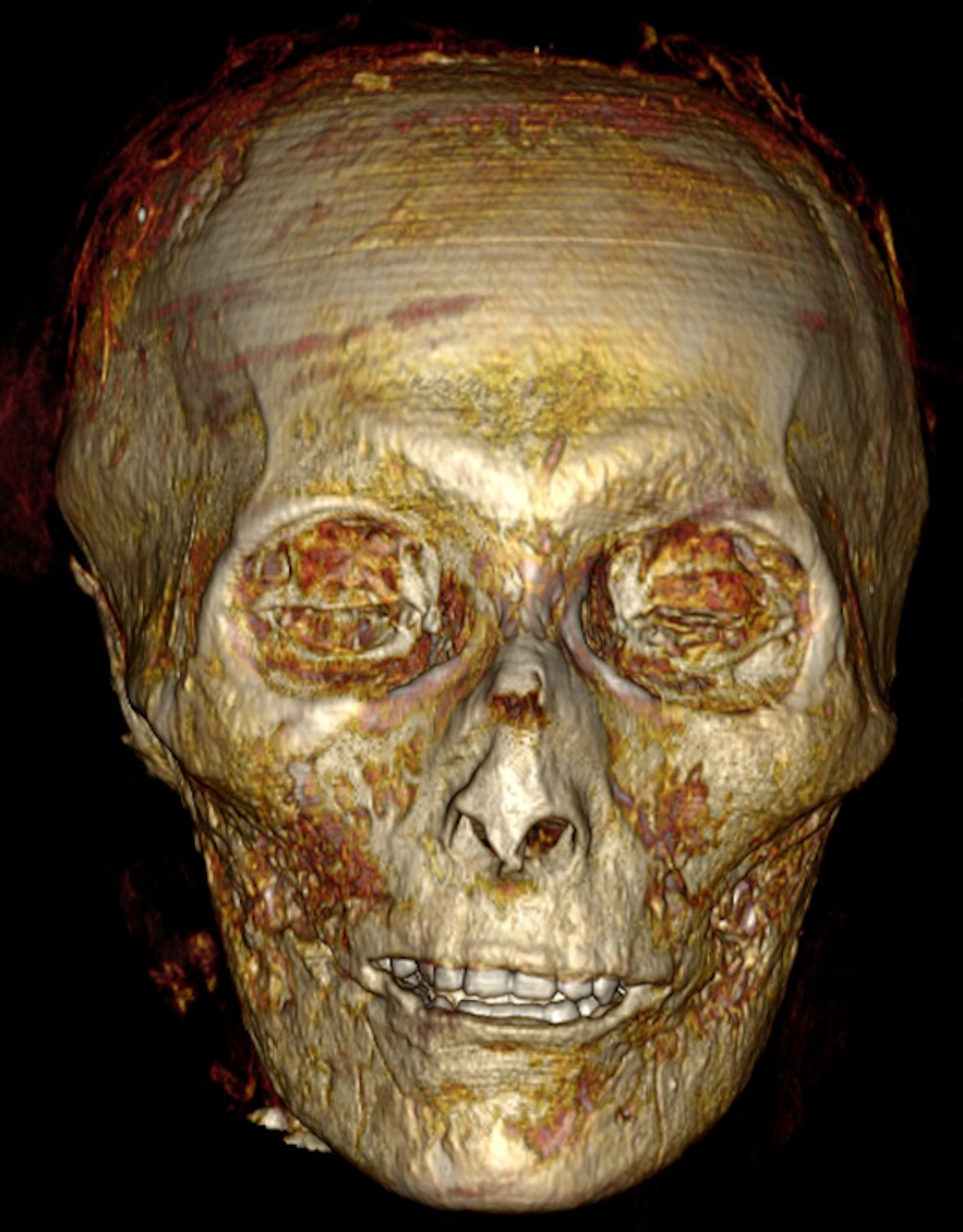 A picture shows the pharoah's skull shown by CT tomography inside its bandages.