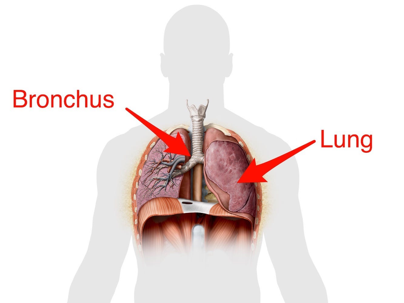 A schematic shows where the bronchus and lungs are on a cross-section of a person