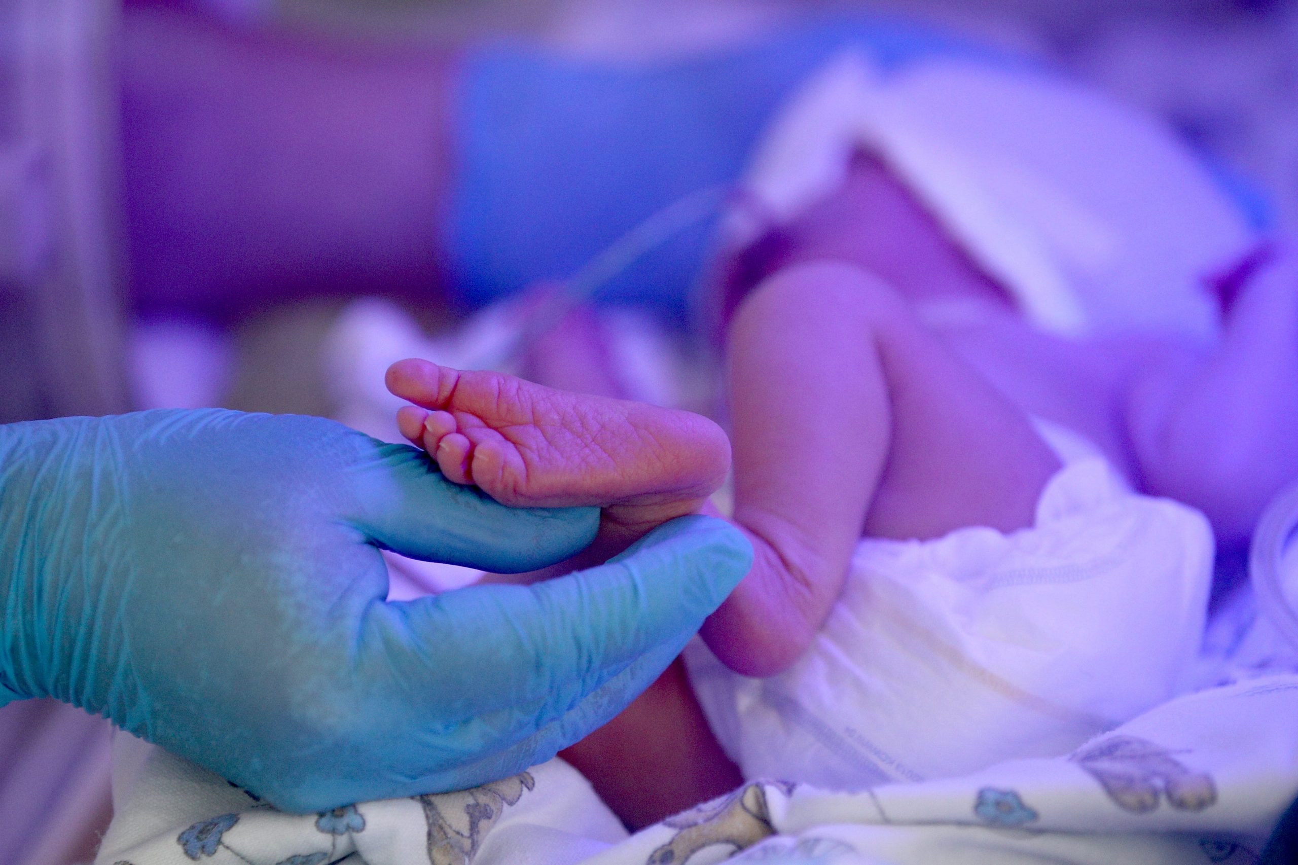 A newborn at an intensive care unit at the perinatal centre of Tatarstan's Republican Clinical Hospital.