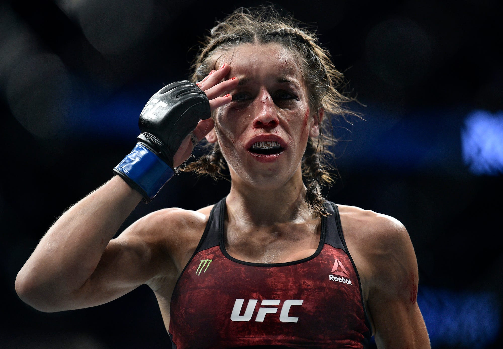 Joanna Jedrzejczyk was left disfigured after five brutal rounds with Weili Zhang.