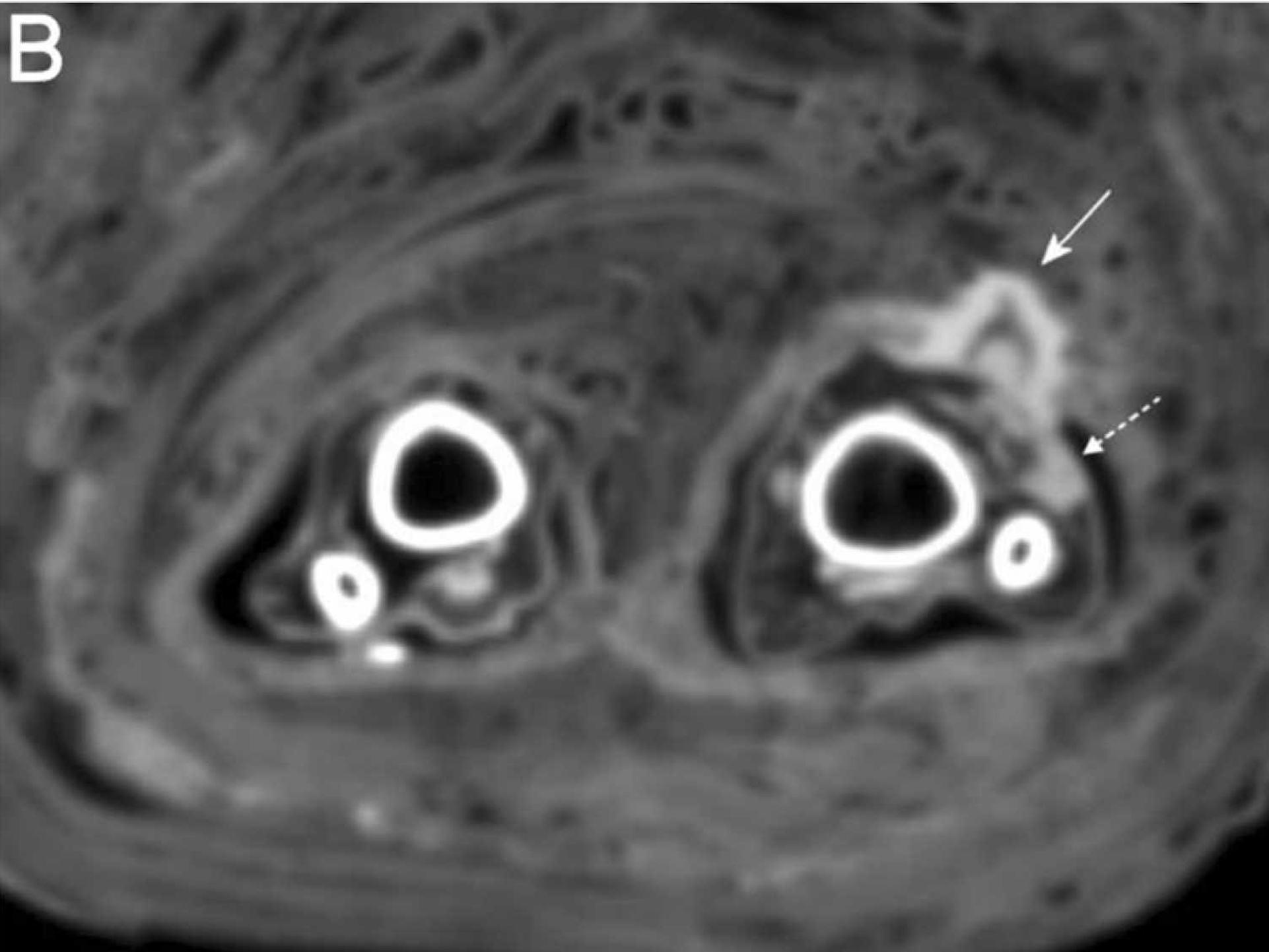 A cross-section of the mummy is seen here.