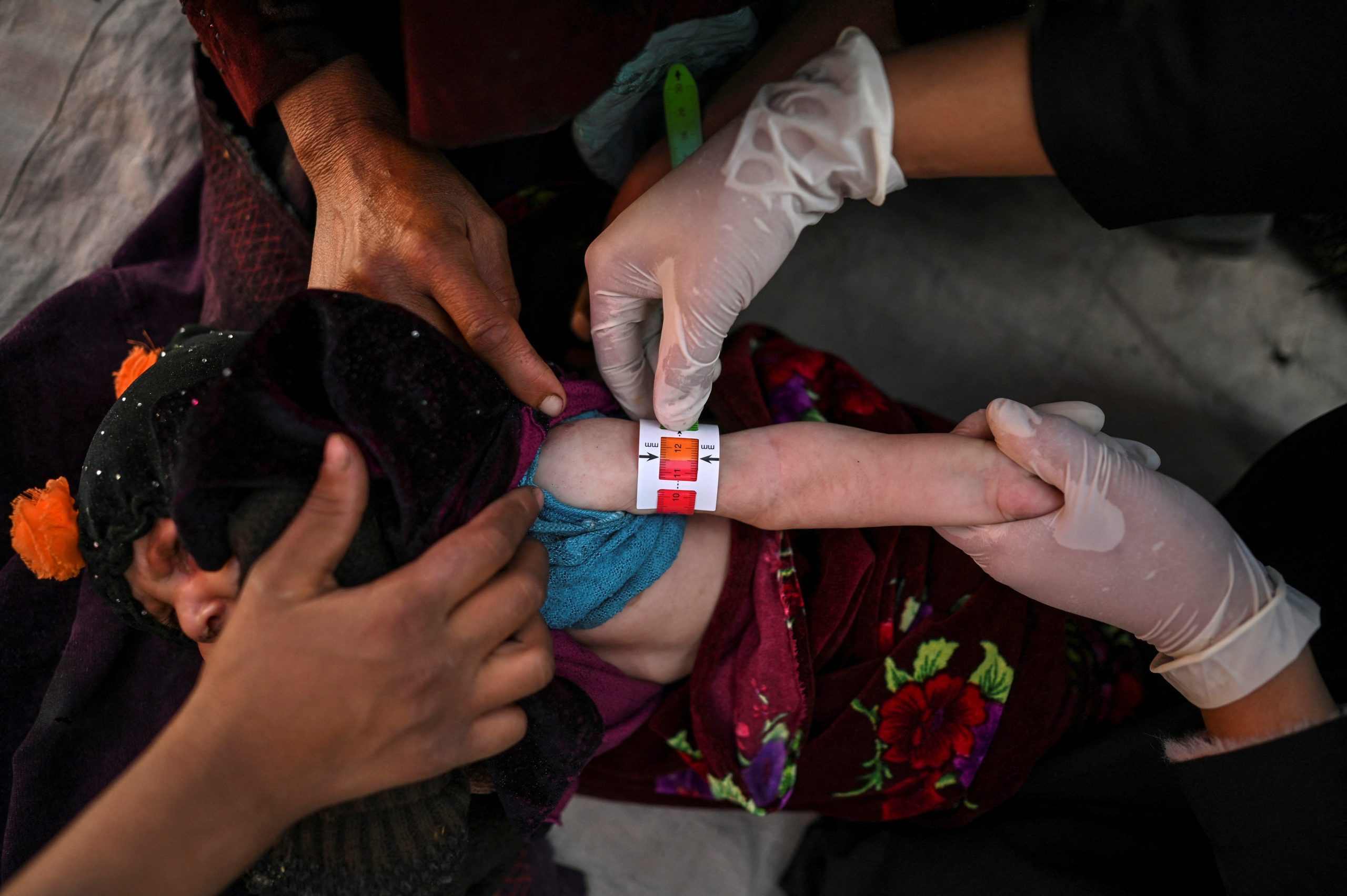 Afghan medical staff checking a child at a Doctors Without Borders clinic.